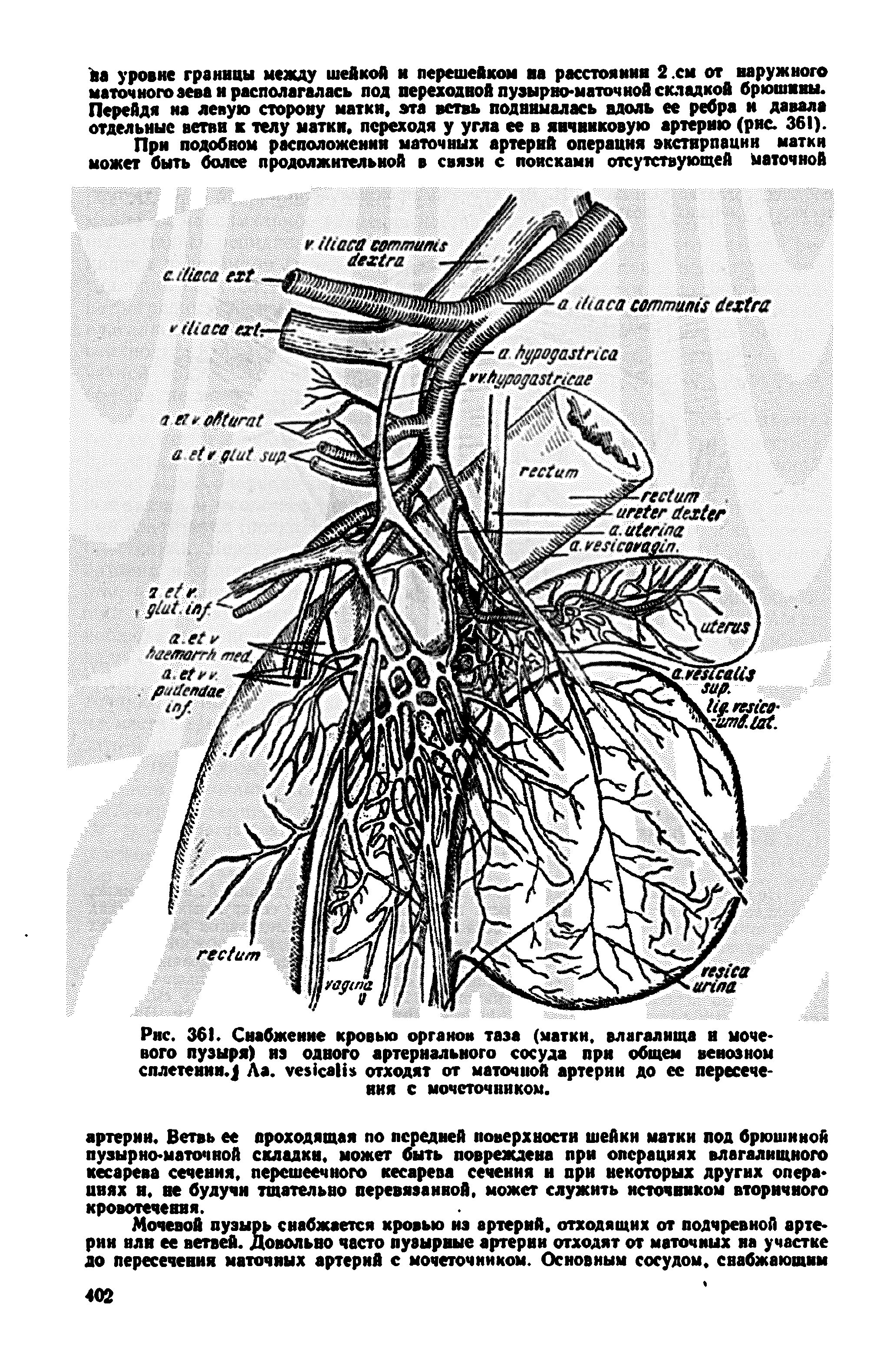 Рис. 36 . Снабжение кровью органов таза (матки, влагалища и мочевого пузыря) из одного артериального сосуда при общем венозном сплетенни. Ла. уезкаНз отходят от маточной артерии до ее пересечения с мочеточником.