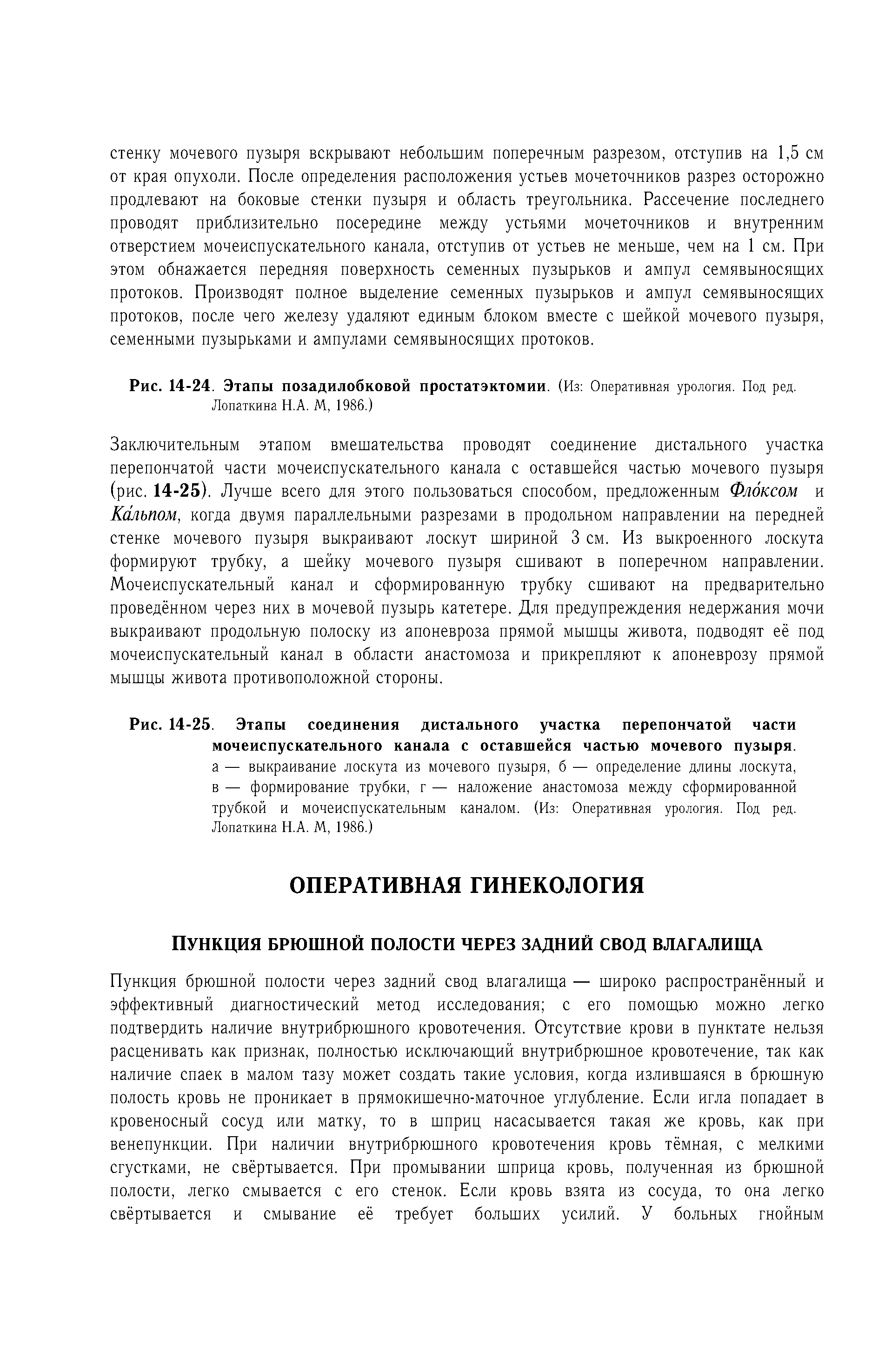 Рис. 14-24. Этапы позадилобковой простатэктомии. (Из Оперативная урология. Под ред. Лопаткина Н.А. М, 1986.)...