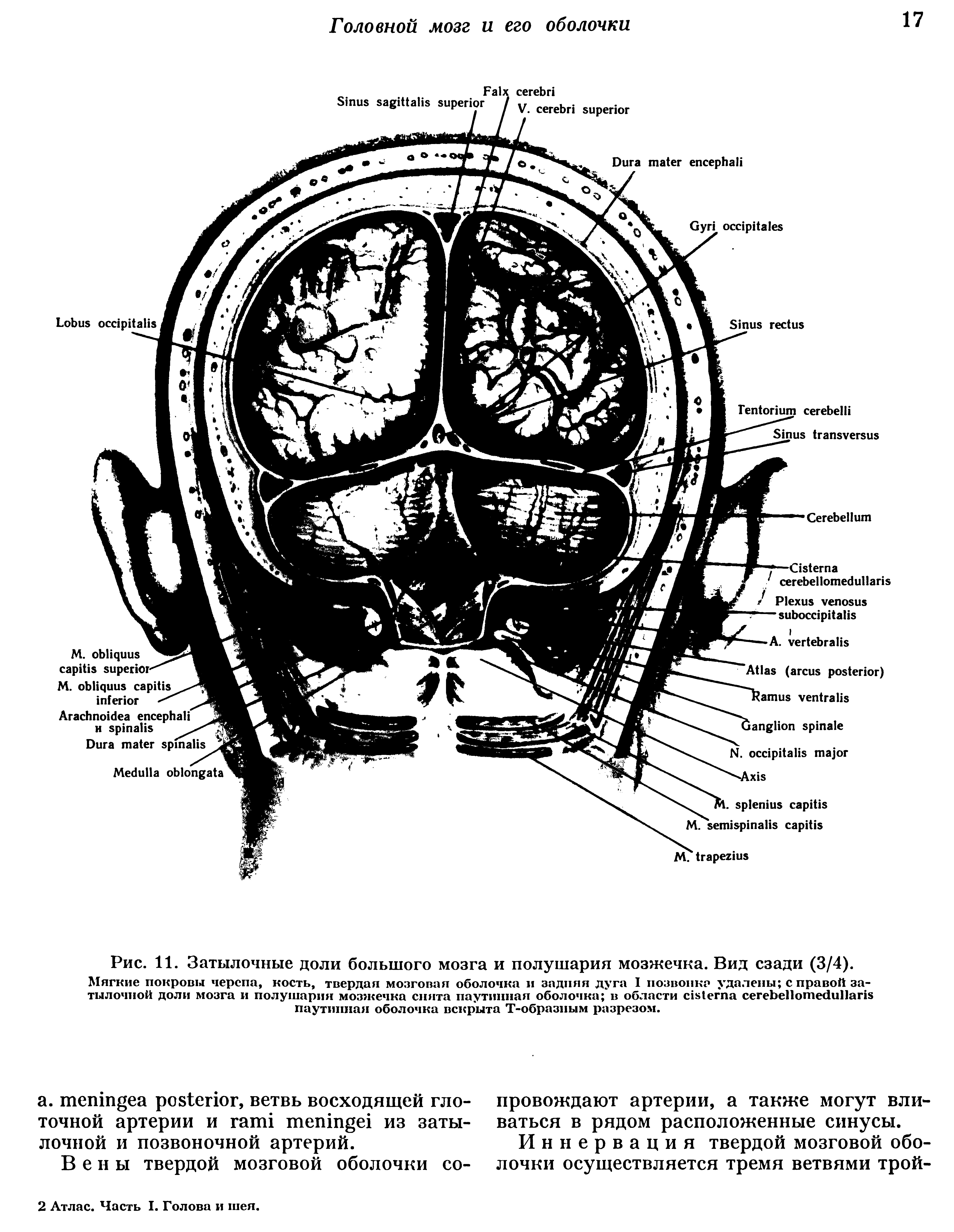 Рис. 11. Затылочные доли большого мозга и полушария мозжечка. Вид сзади (3/4).