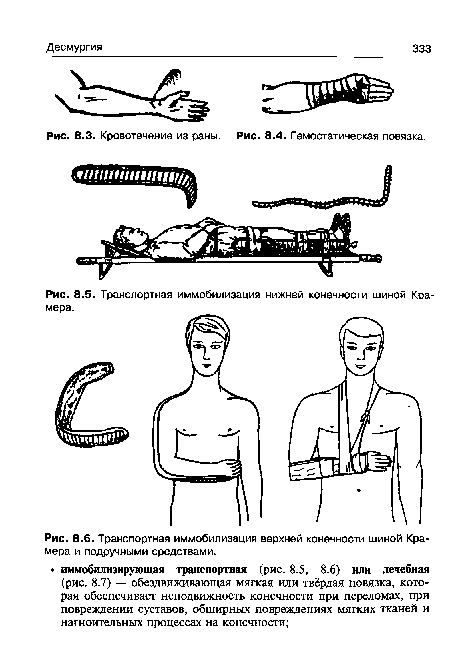 Рис. 8.6. Транспортная иммобилизация верхней конечности шиной Крамера и подручными средствами.