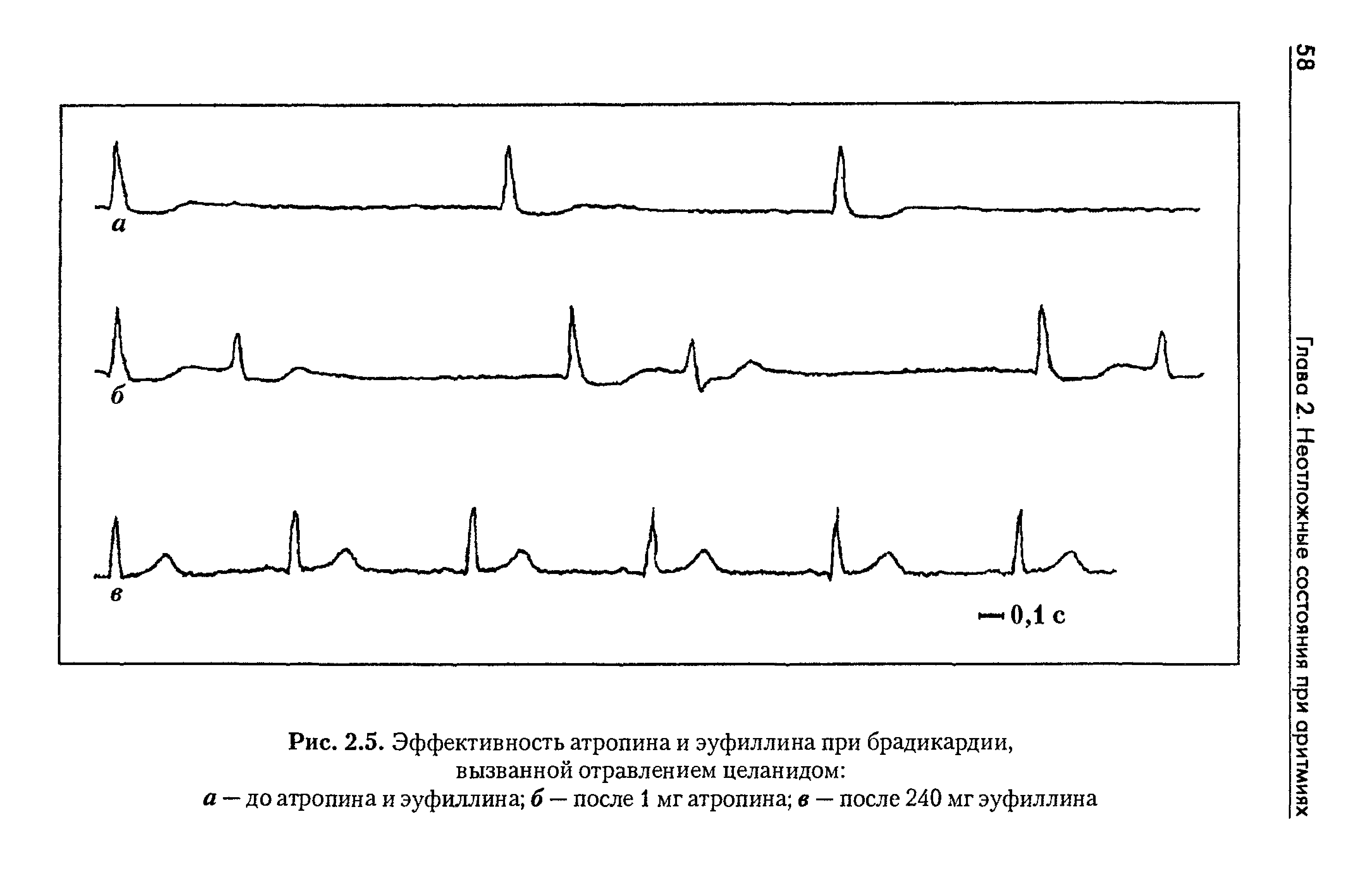 Рис. 2.5. Эффективность атропина и эуфиллина при брадикардии, вызванной отравлением целанидом ...