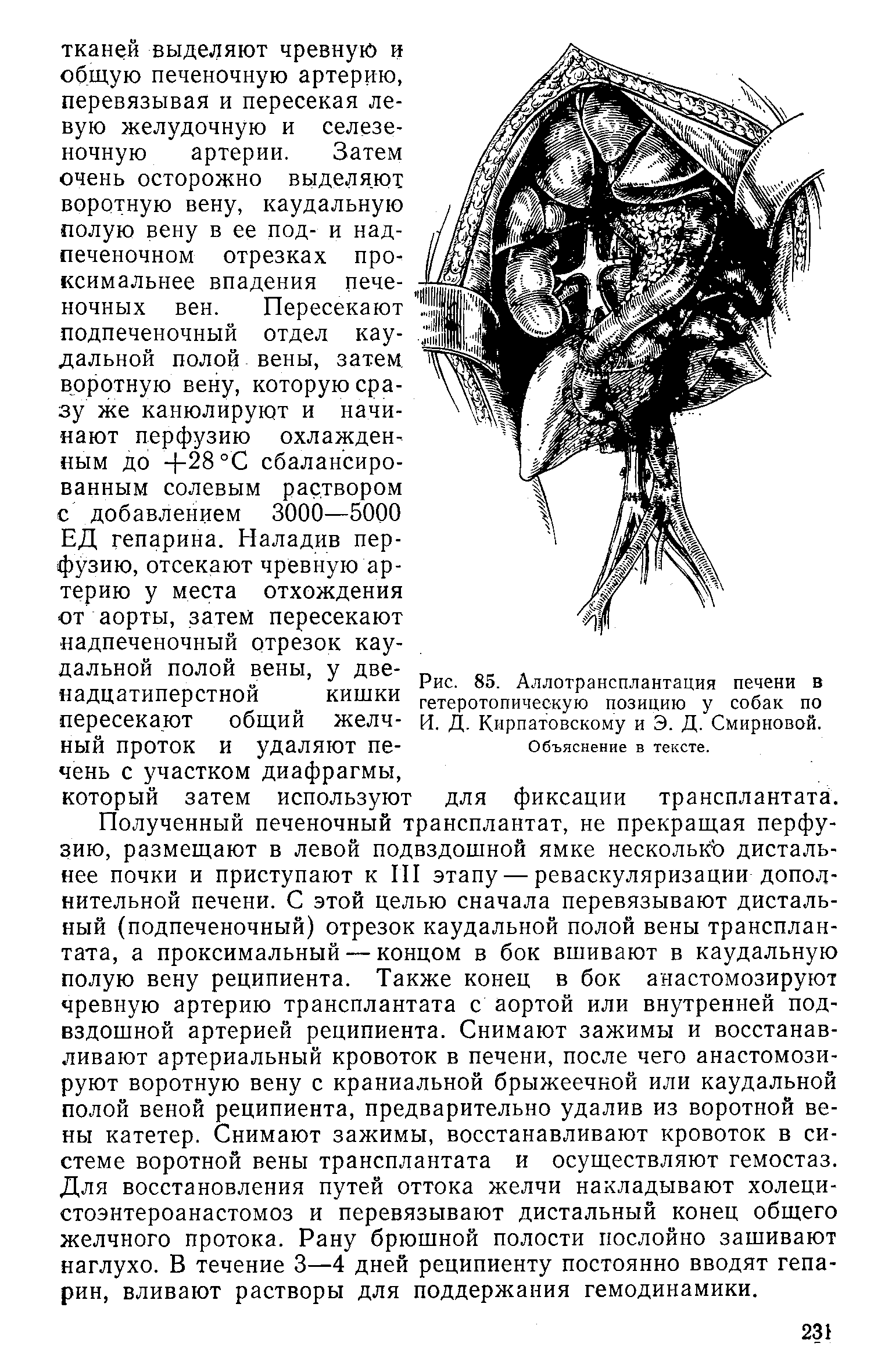 Рис. 85. Аллотрансплантация печени в гетеротопическую позицию у собак по И. Д. Кирпатовскому и Э. Д. Смирновой.