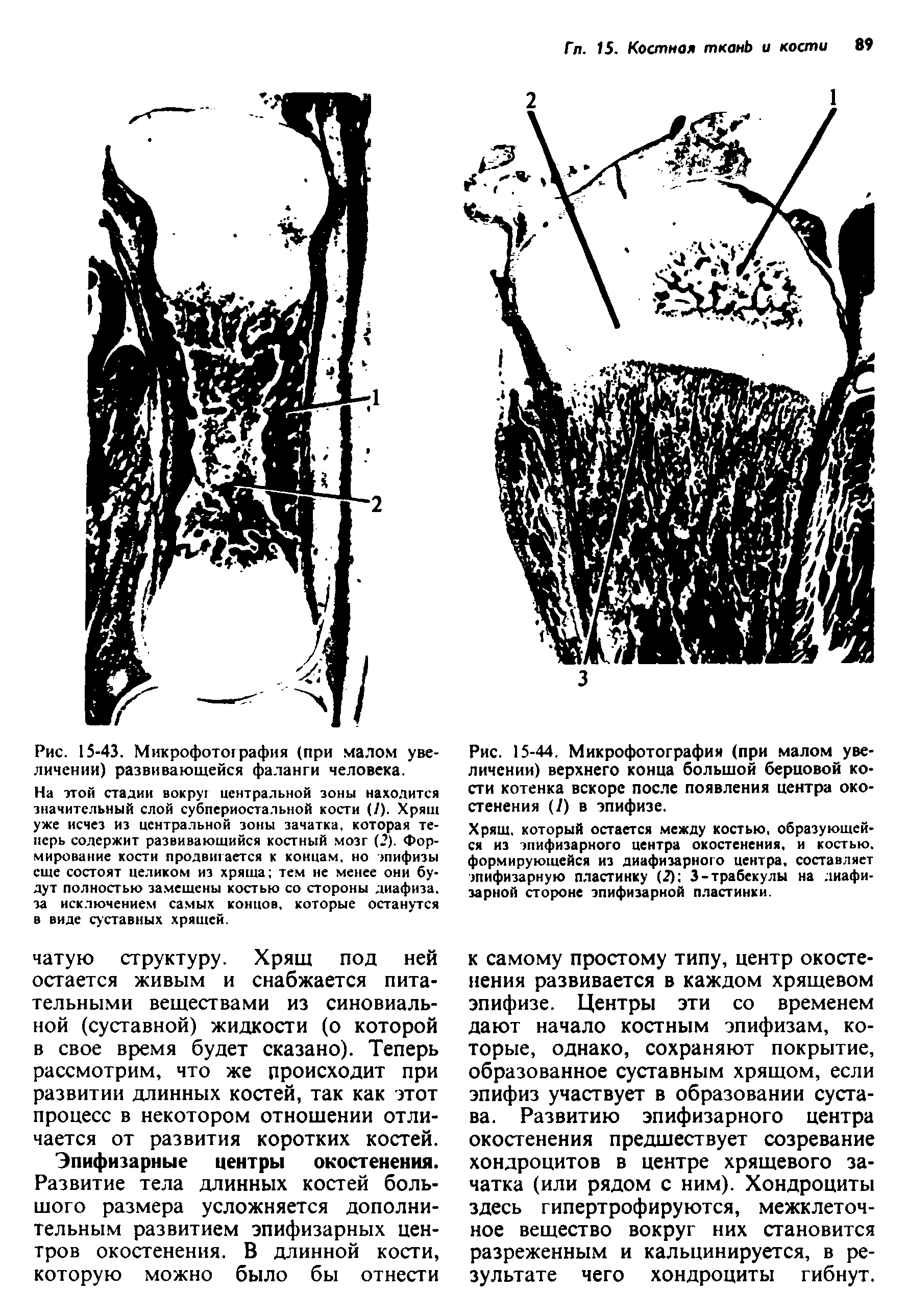 Рис. 15-44. Микрофотография (при малом увеличении) верхнего конца большой берцовой кости котенка вскоре после появления центра окостенения (/) в эпифизе.