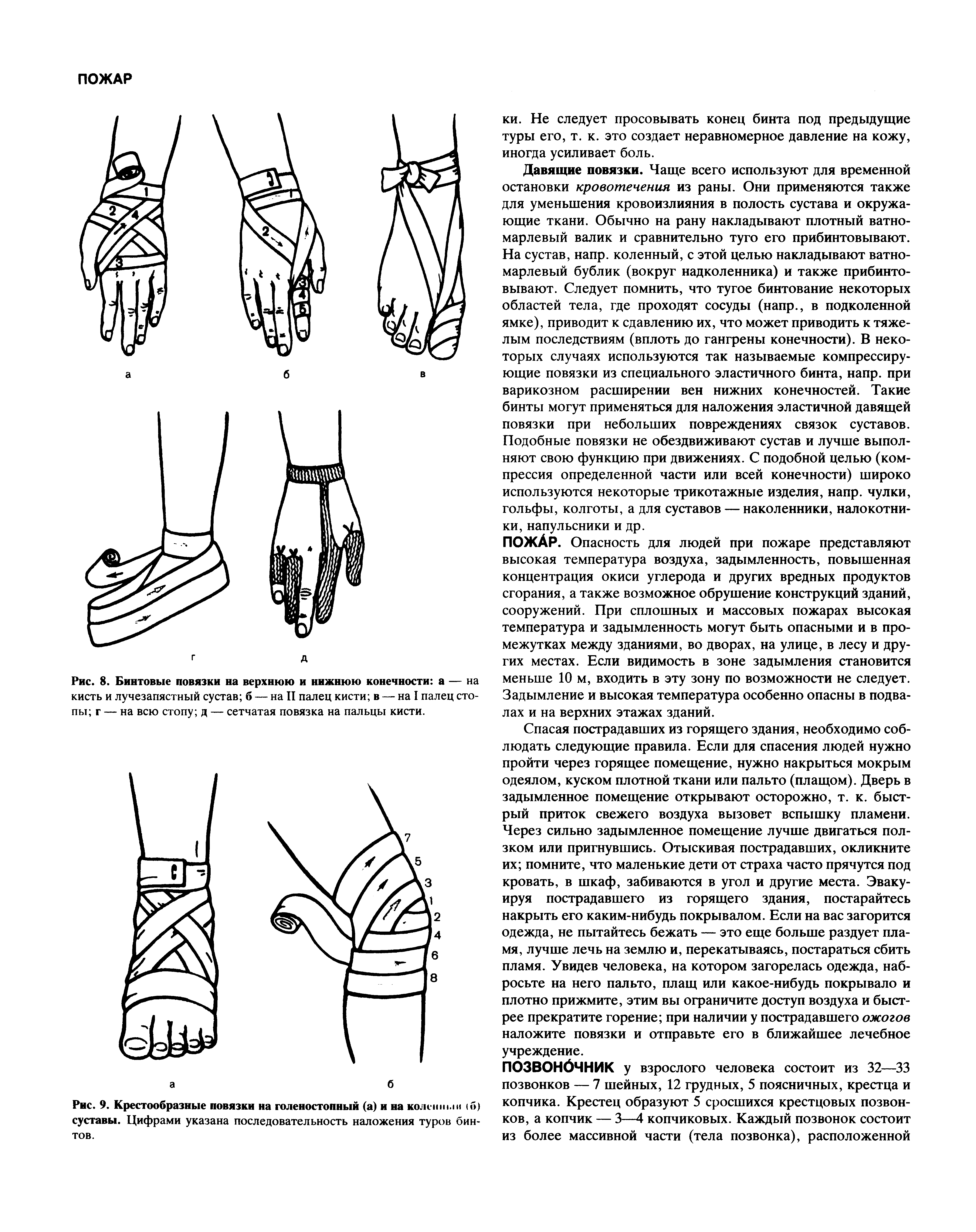 Рис. 8. Бинтовые повязки на верхнюю и нижнюю конечности а — на кисть и лучезапястный сустав б — на II палец кисти в — на I палец стопы г — на всю стопу д — сетчатая повязка на пальцы кисти.