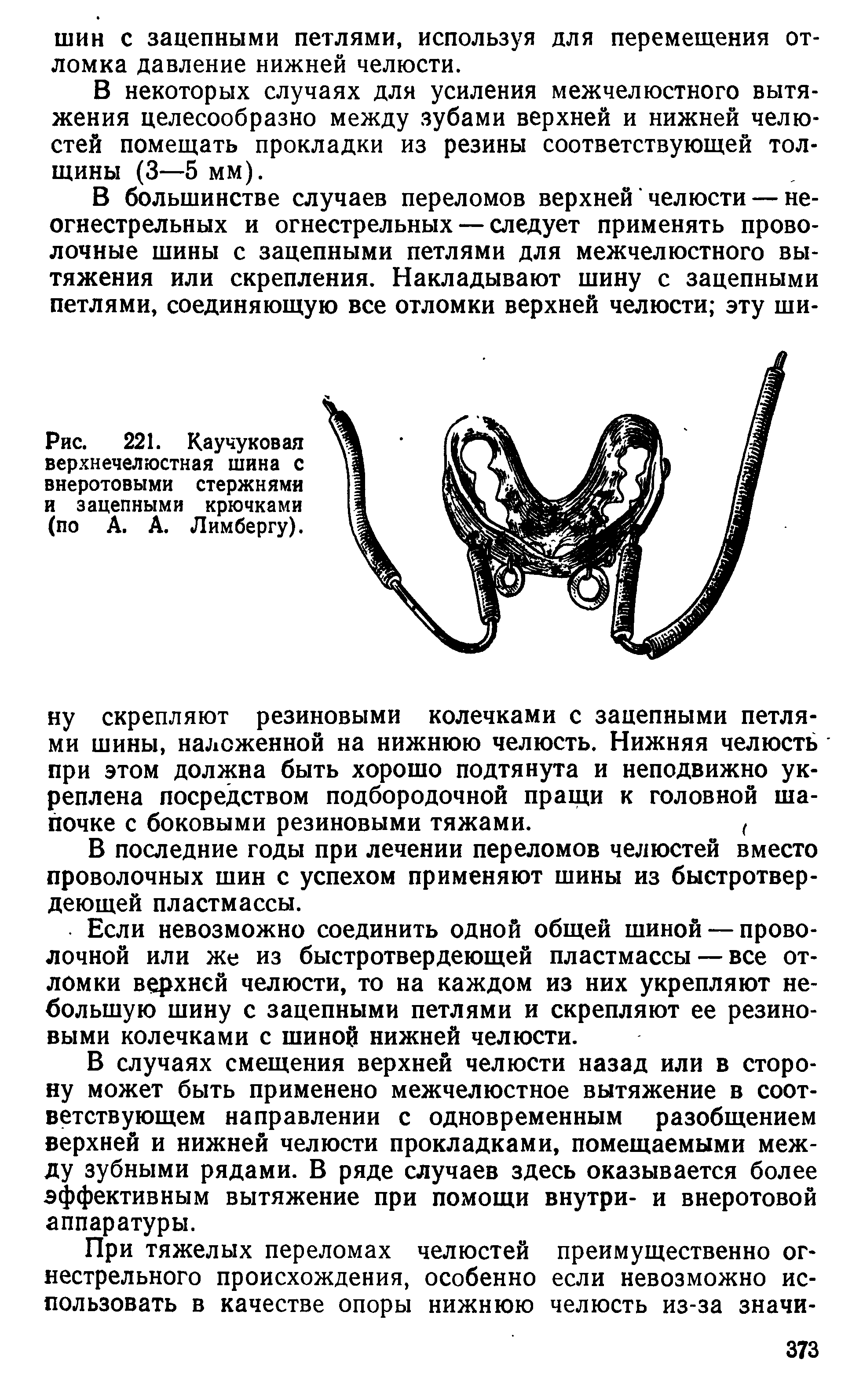 Рис. 221. Каучуковая верхнечелюстная шина с внеротовыми стержнями и зацепными крючками (по А. А. Лимбергу).