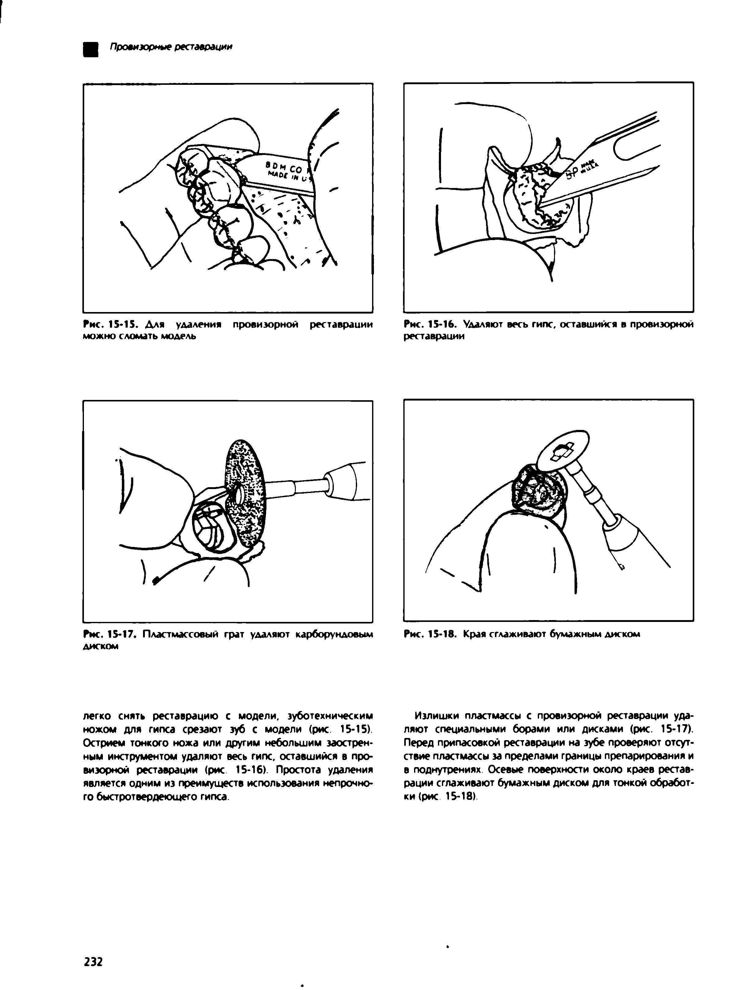 Рис. 15-16. Удаляют весь гипс, оставшийся в провизорной реставрации...