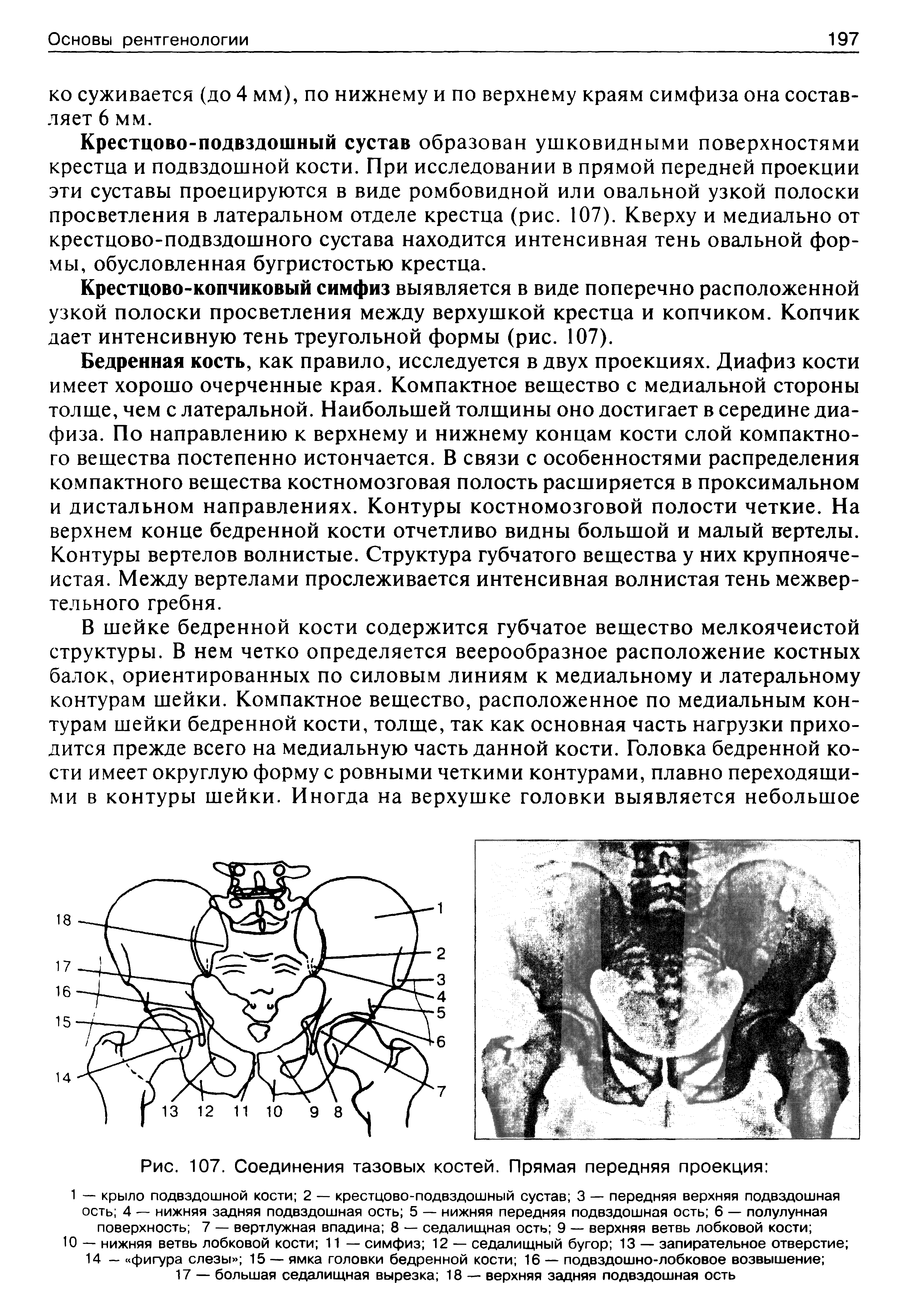 Рис. 107. Соединения тазовых костей. Прямая передняя проекция ...