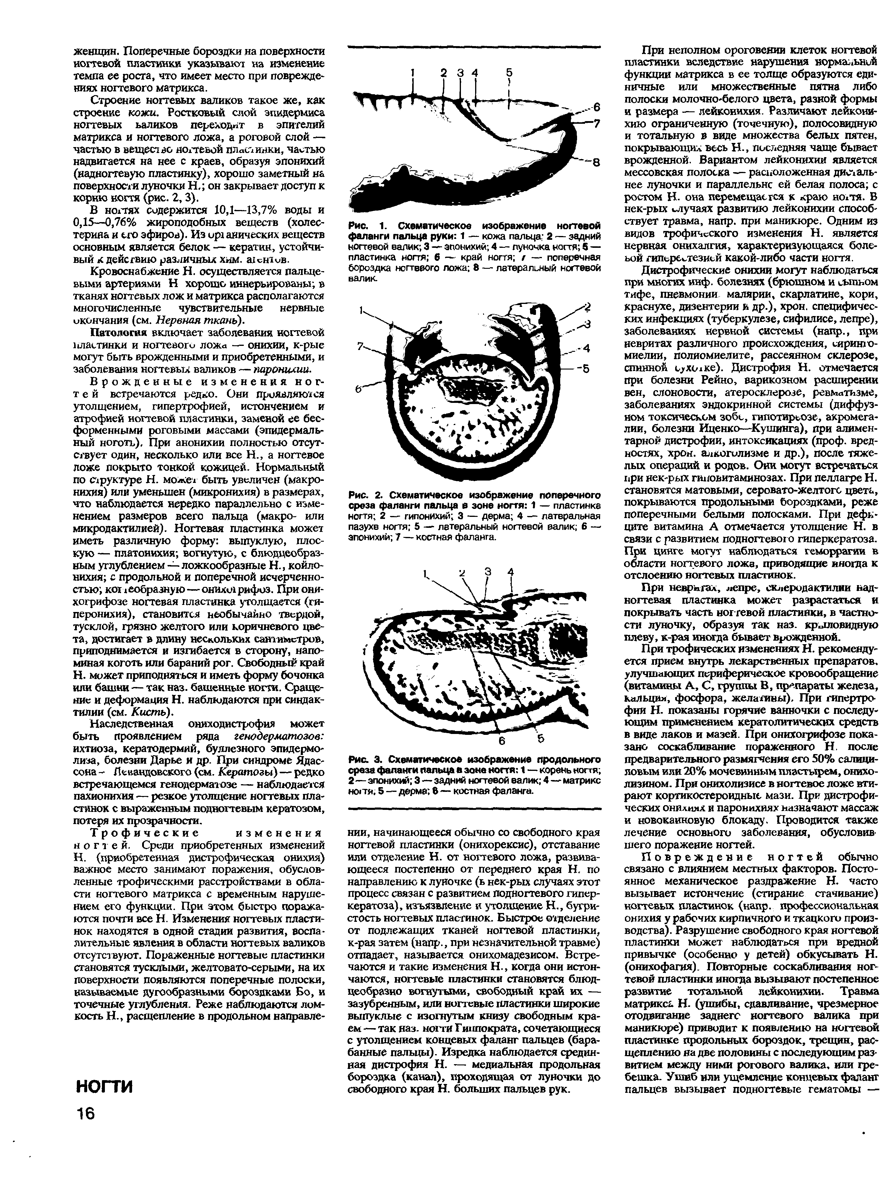 Рис. 2. Схематическое изображение поперечного среза фаланги пальца а зоне ногтя 1 — пластинка ногтя 2 — гипонихий 3 — дерма 4 — латеральная пазухв ногтя 5 — латеральный ногтевой валик 6 — эпонихий 7 — костная фаланга.