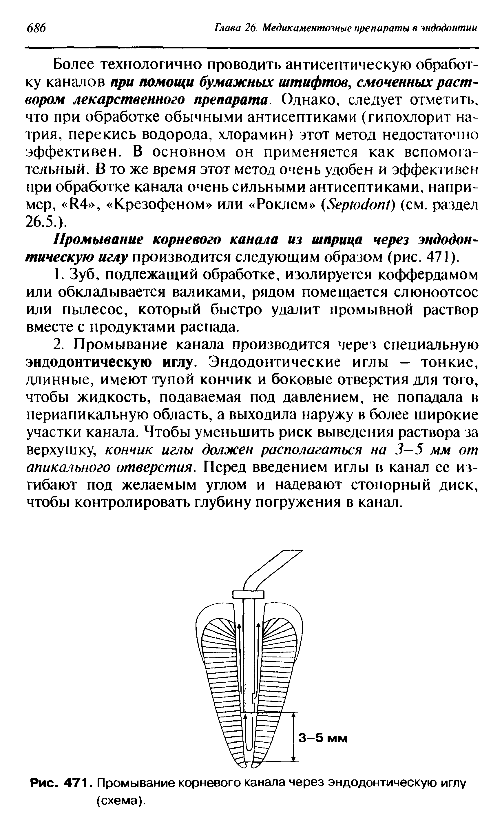 Рис. 471. Промывание корневого канала через эндодонтическую иглу (схема).