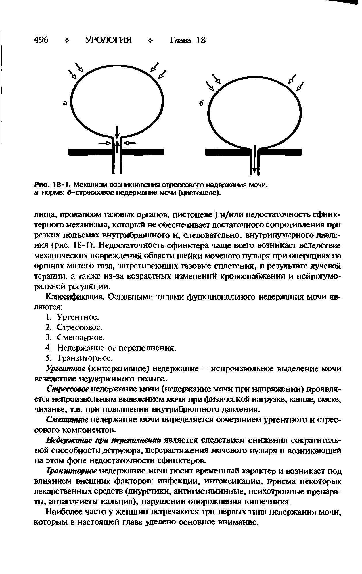 Рис. 18-1. Механизм возникновения стрессового недержания мочи, а-нормв б-стрессовое недержание мочи (цистоцеле).