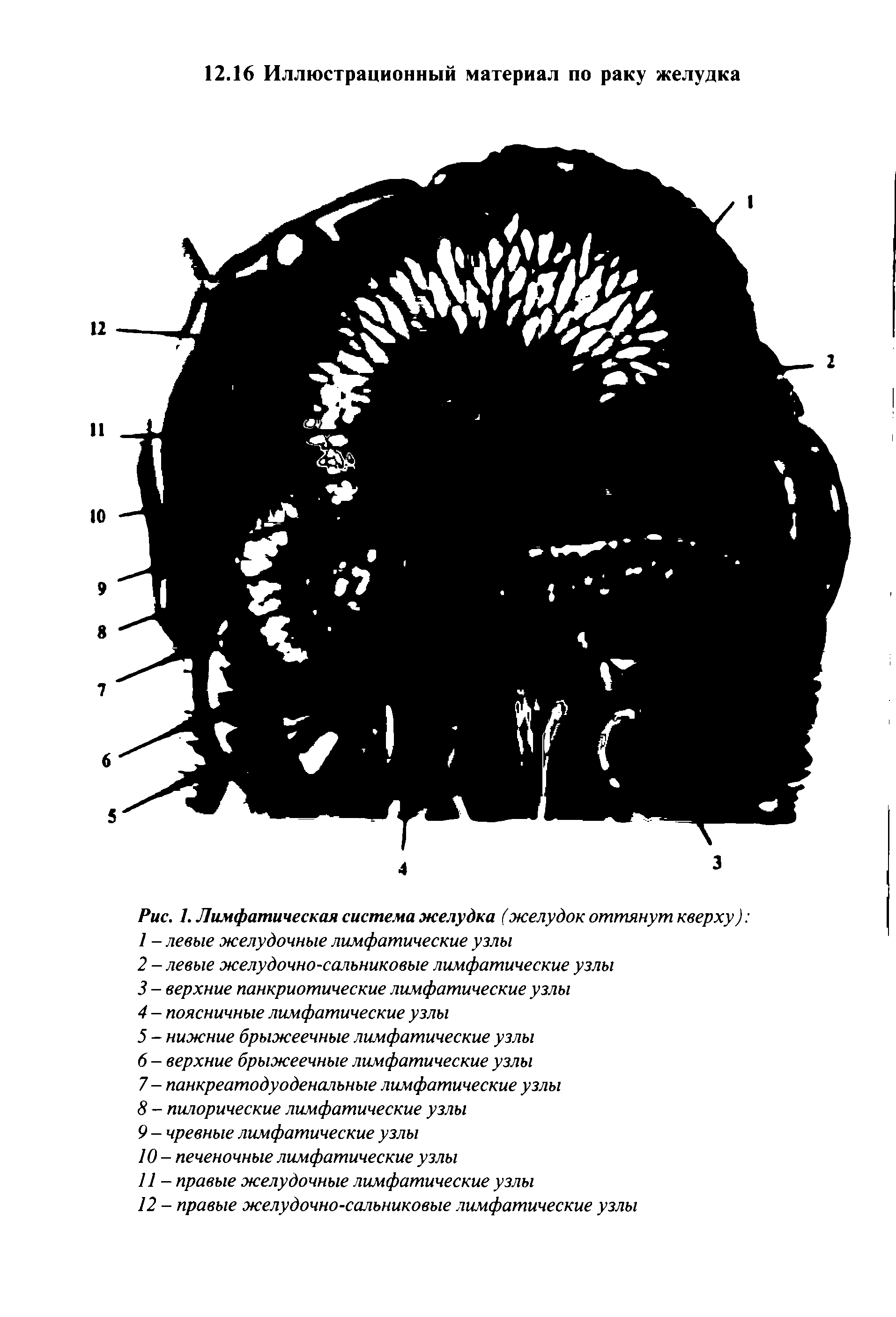 Рис. 1. Лимфатическая система желудка (желудок оттянут кверху) ...