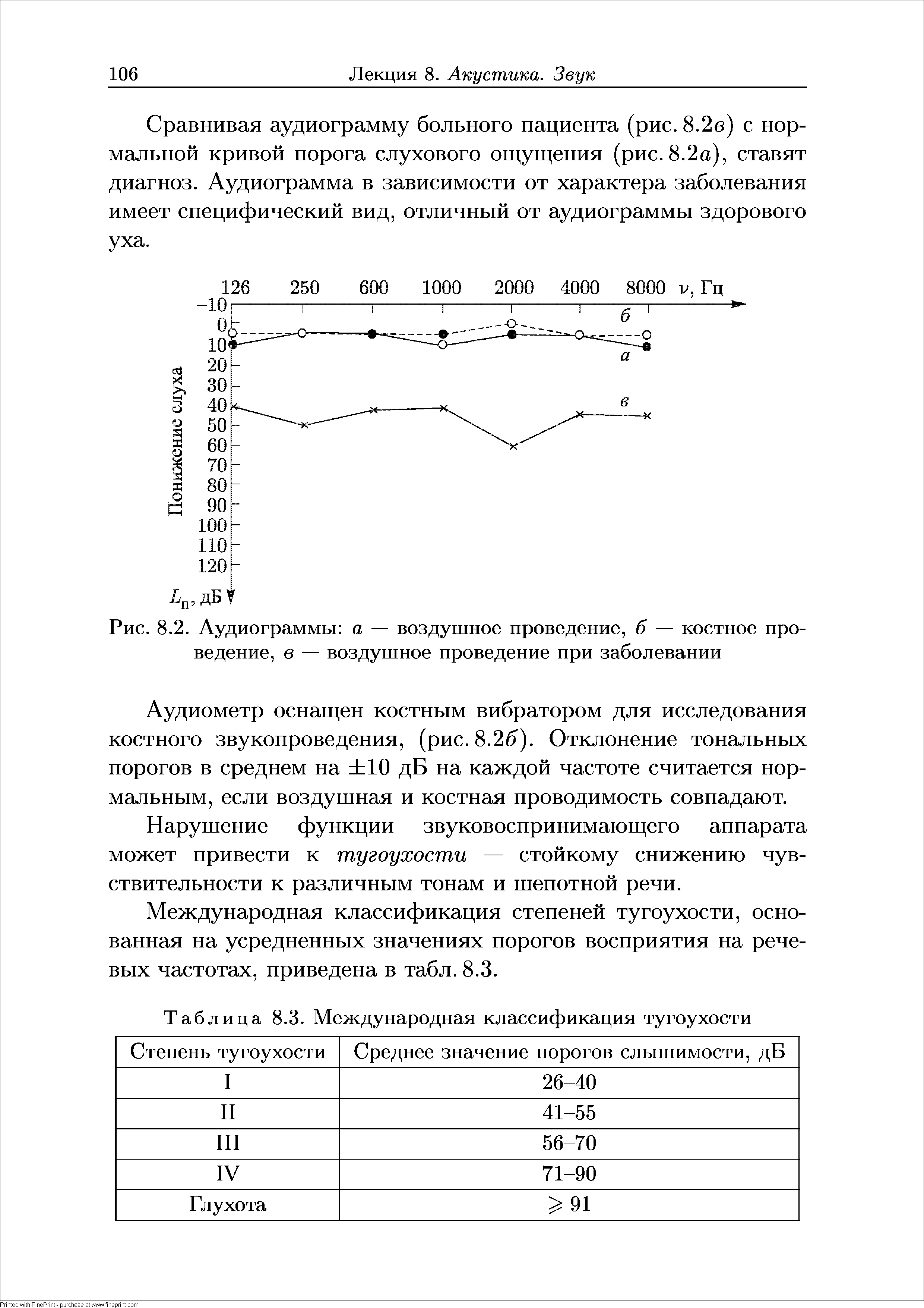 Рис. 8.2. Аудиограммы а — воздушное проведение, б — костное проведение, в — воздушное проведение при заболевании...