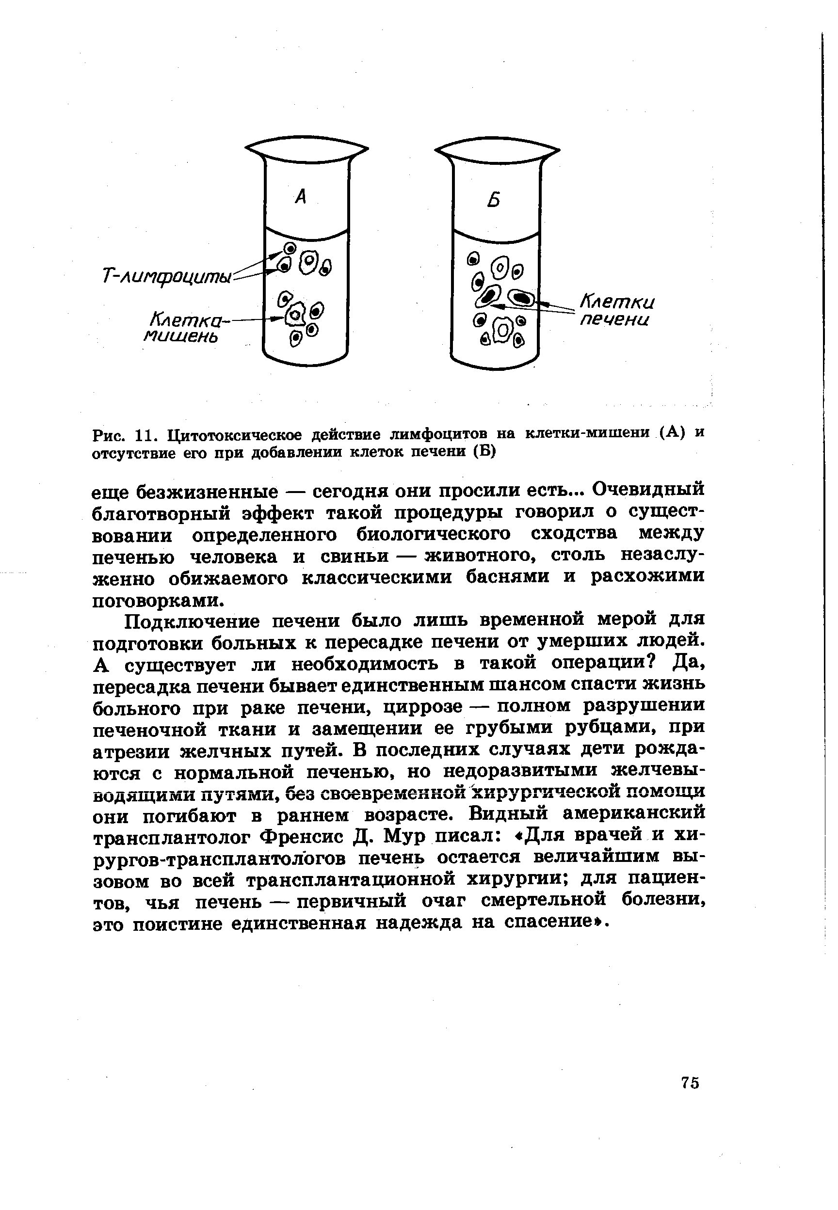 Рис. 11. Цитотоксическое действие лимфоцитов на клетки-мишени (А) и отсутствие его при добавлении клеток печени (Б)...