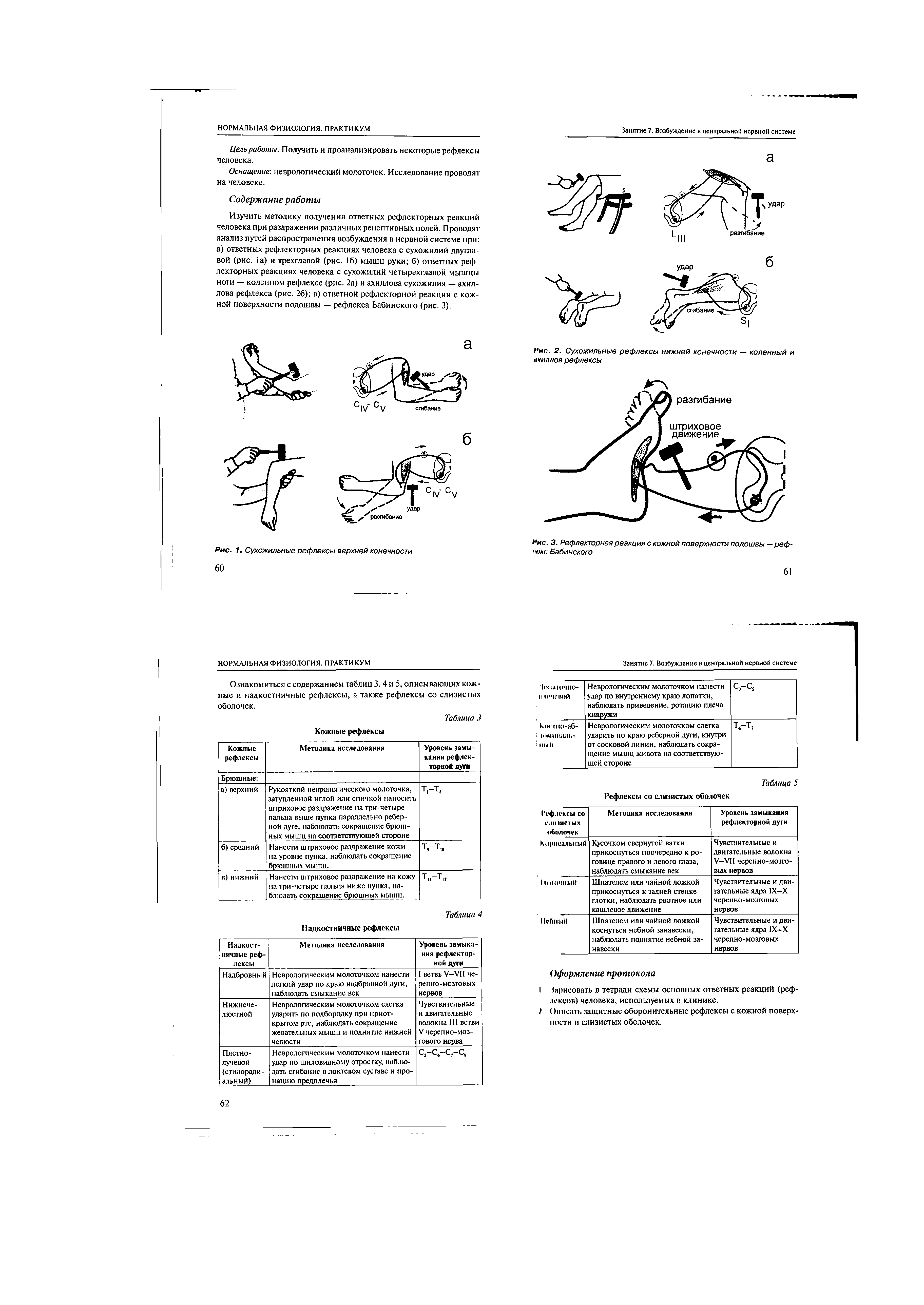 Рис. 2. Сухожильные рефлексы нижней конечности — коленный и ахиллов рефлексы...