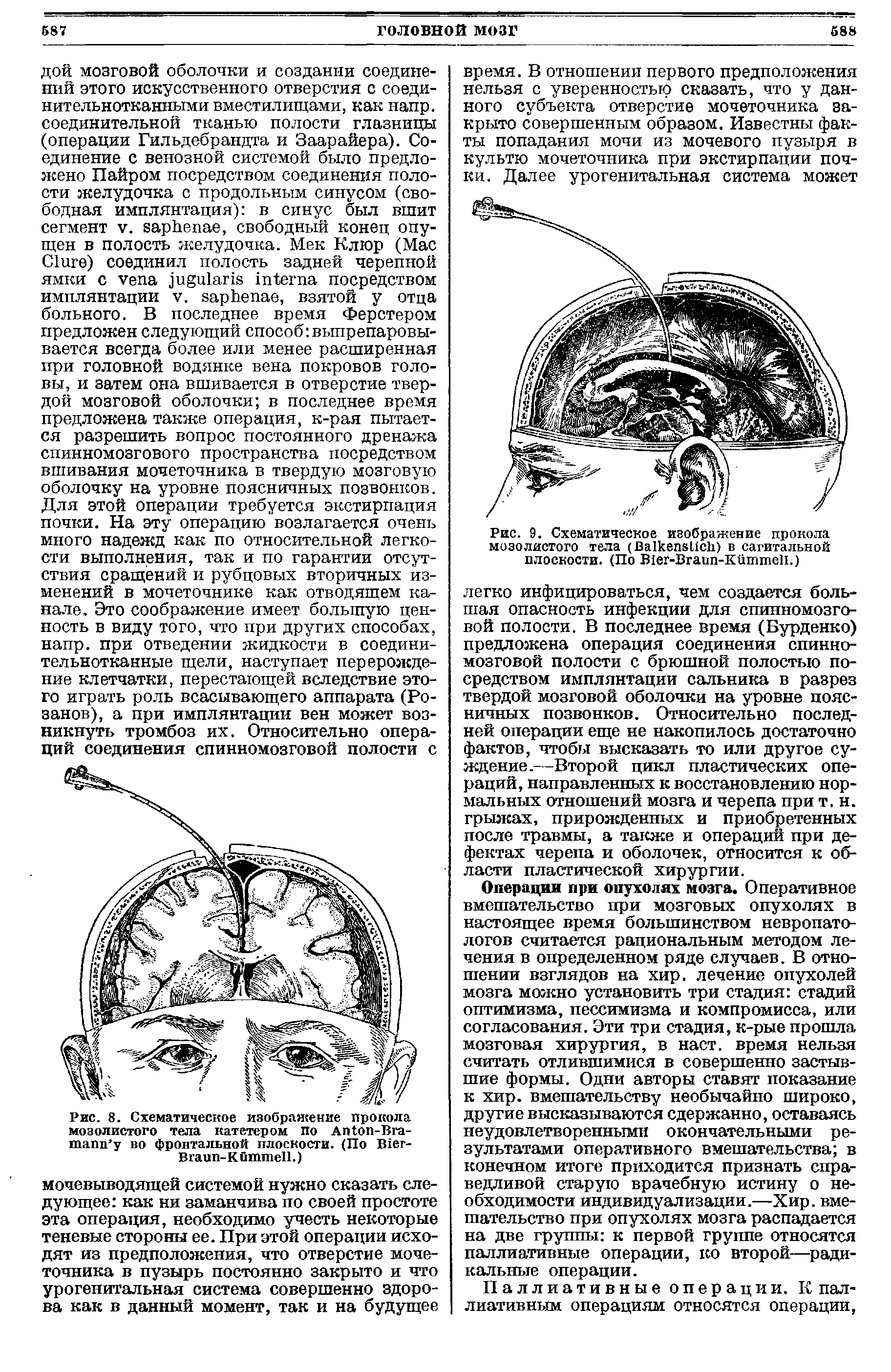 Рис. 9. Схематическое изображение прокола мозолистого тела (B ) в сагитальной плоскости. (По B -B -K .)...