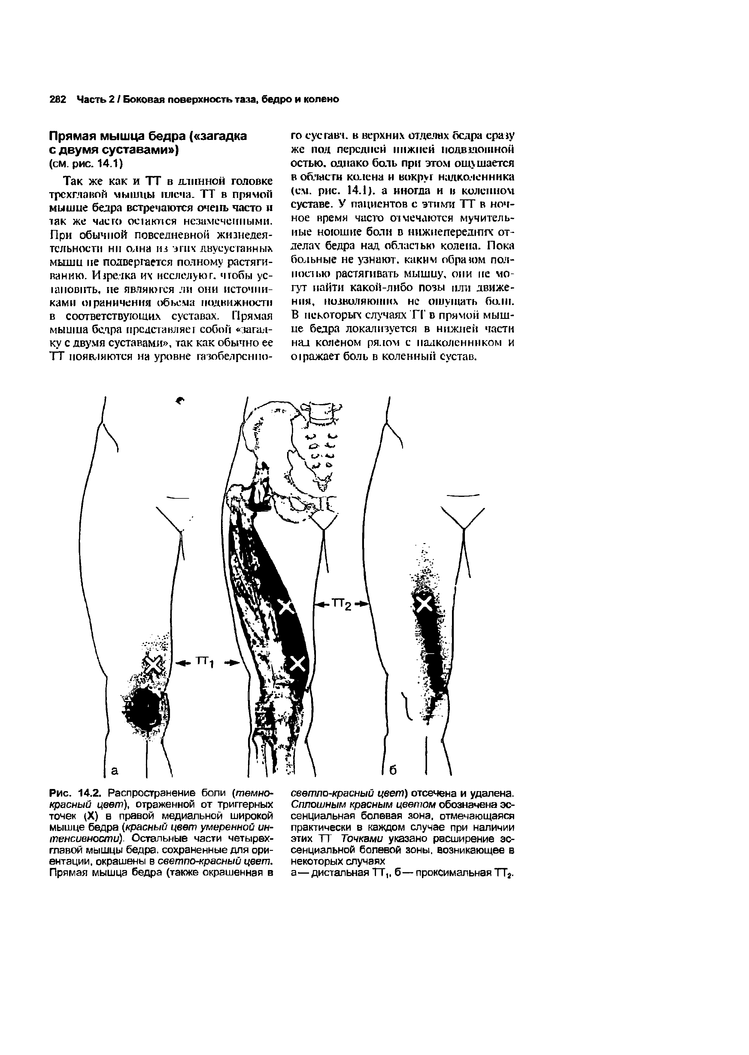 Рис. 14.2. Распространение боли (темнокрасный цвет), отраженной от триггерных точек (X) в правой медиальной широкой мышце бедра (красный цвет умеренной интенсивности). Остальные части четырехглавой мышцы бедра, сохраненные для ориентации, окрашены в светло-красный цвет. Прямая мышца бедра (также окрашенная в...