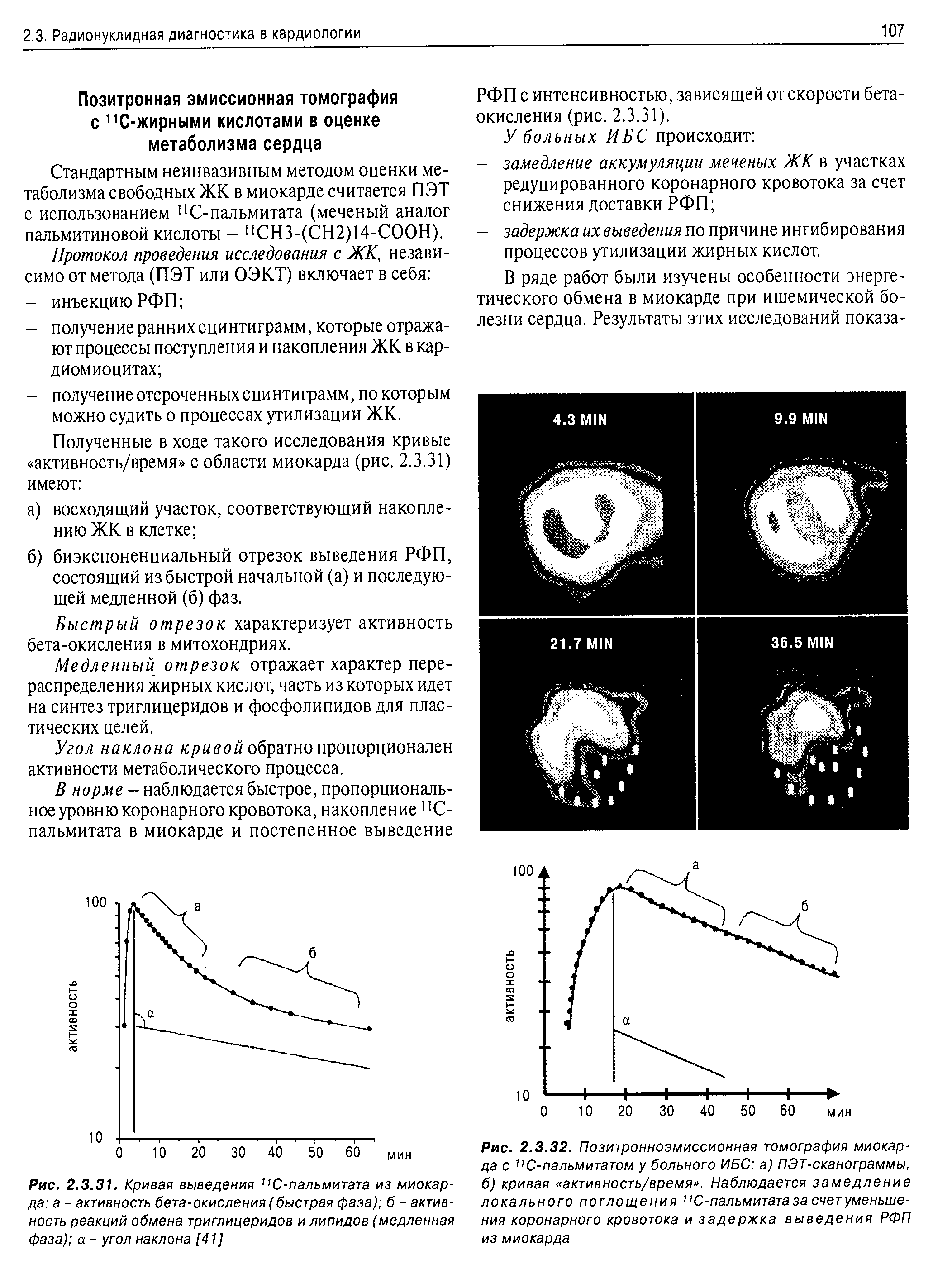 Рис. 2.3.32. Позитронноэмиссионная томография миокарда с С-пальмитатом у больного ИБС а) ПЭТ-сканограммы, б) кривая активность/время . Наблюдается замедление локального поглощения 11С-пальмитатазасчетуменьше-ния коронарного кровотока и задержка выведения РФП из миокарда...