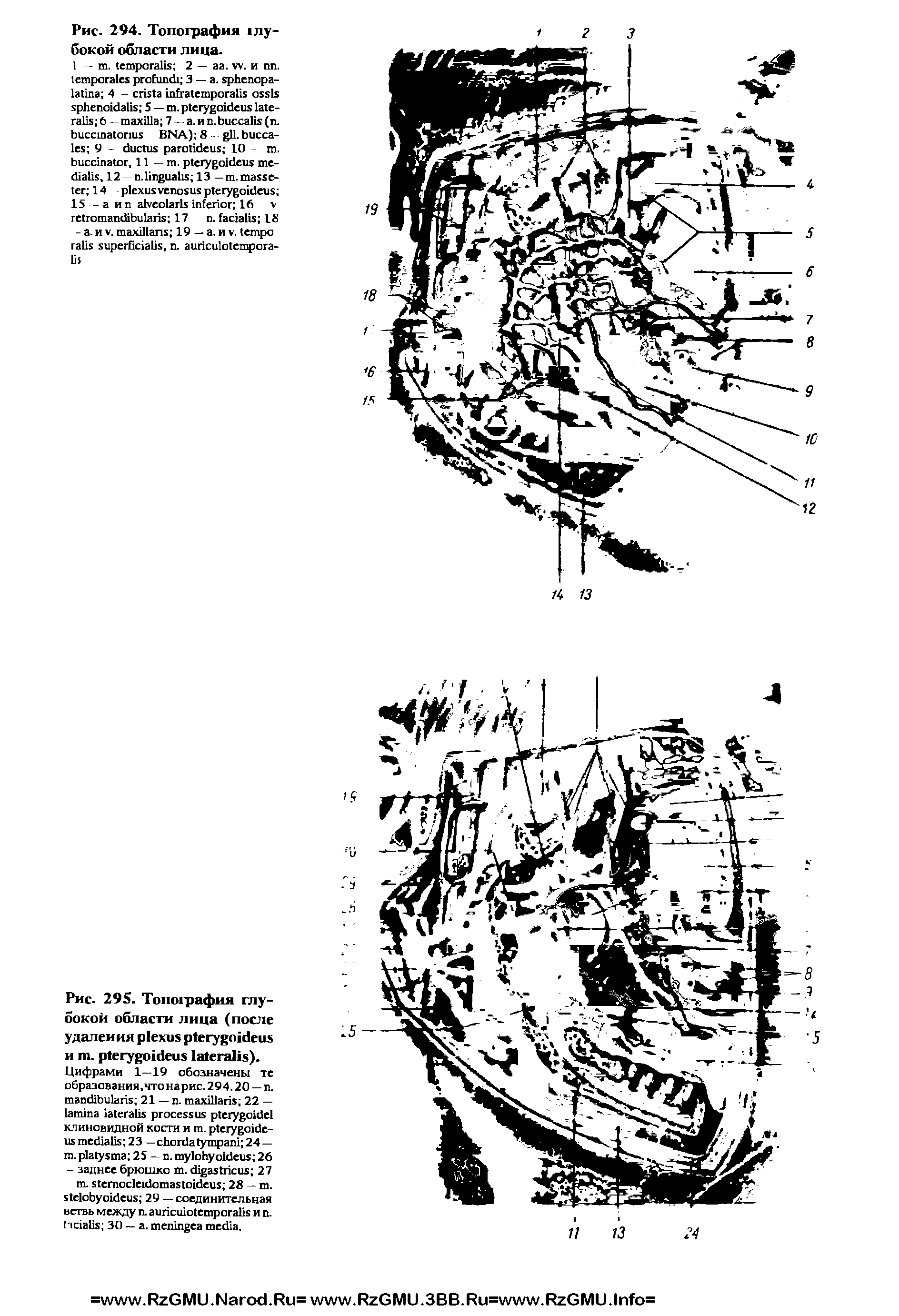 Рис. 295. Топография глубокой области лица (после удаления и . ).