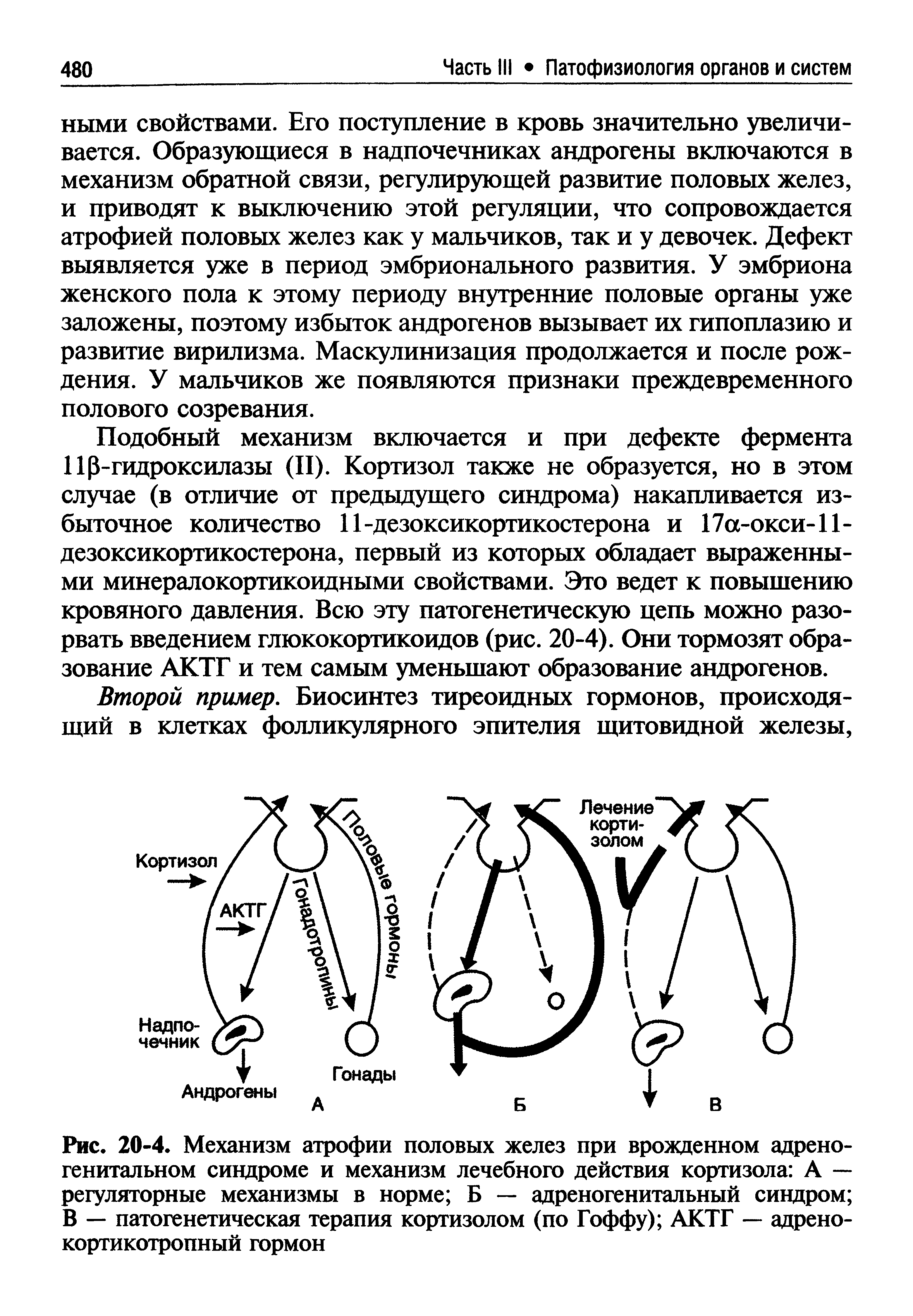 Рис. 20-4. Механизм атрофии половых желез при врожденном адрено-генитальном синдроме и механизм лечебного действия кортизола А — регуляторные механизмы в норме Б — адреногенитальный синдром В — патогенетическая терапия кортизолом (по Гоффу) АКТГ — адренокортикотропный гормон...