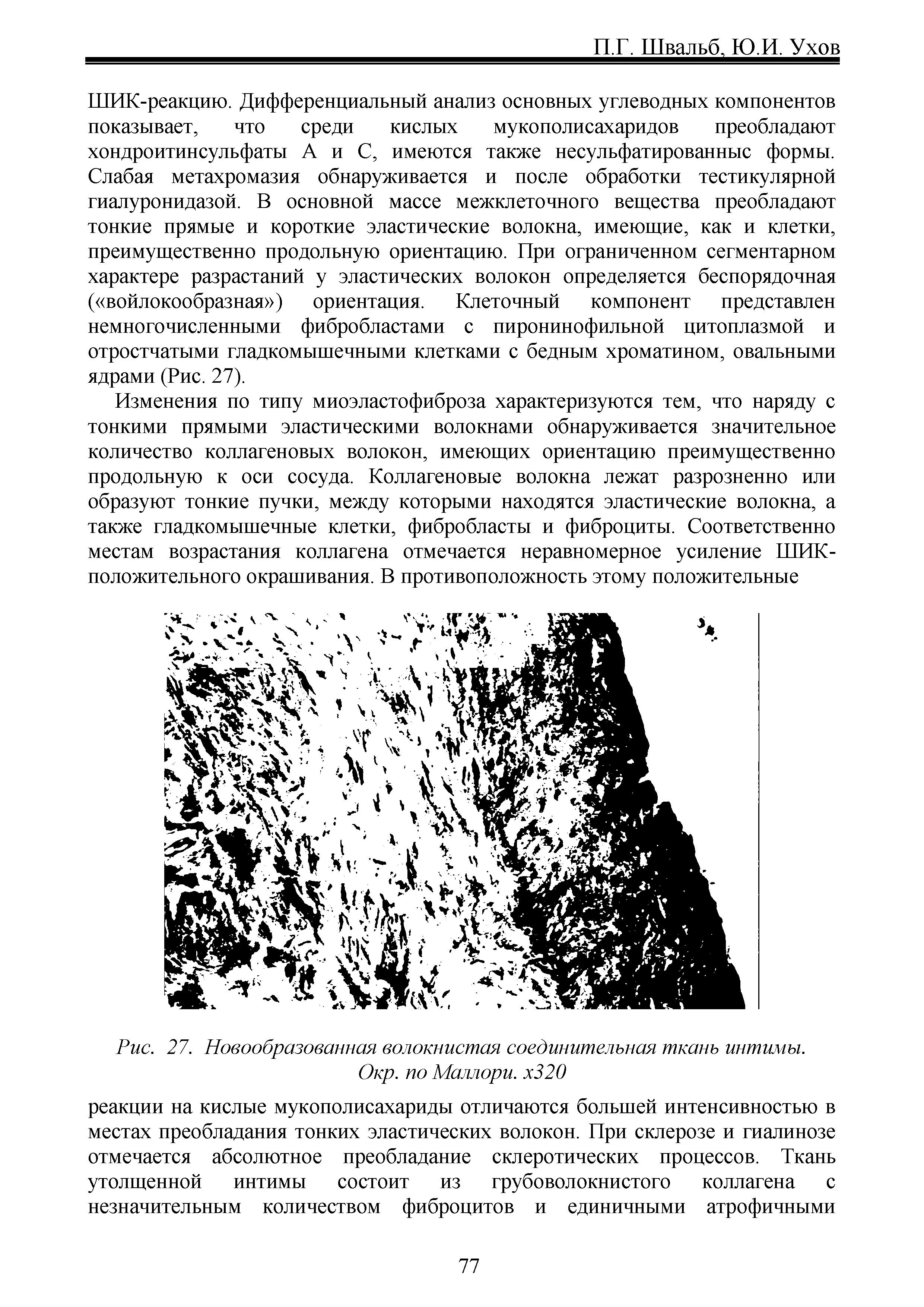 Рис. 27. Новообразованная волокнистая соединительная ткань интимы. Окр. по Маллори. х320...