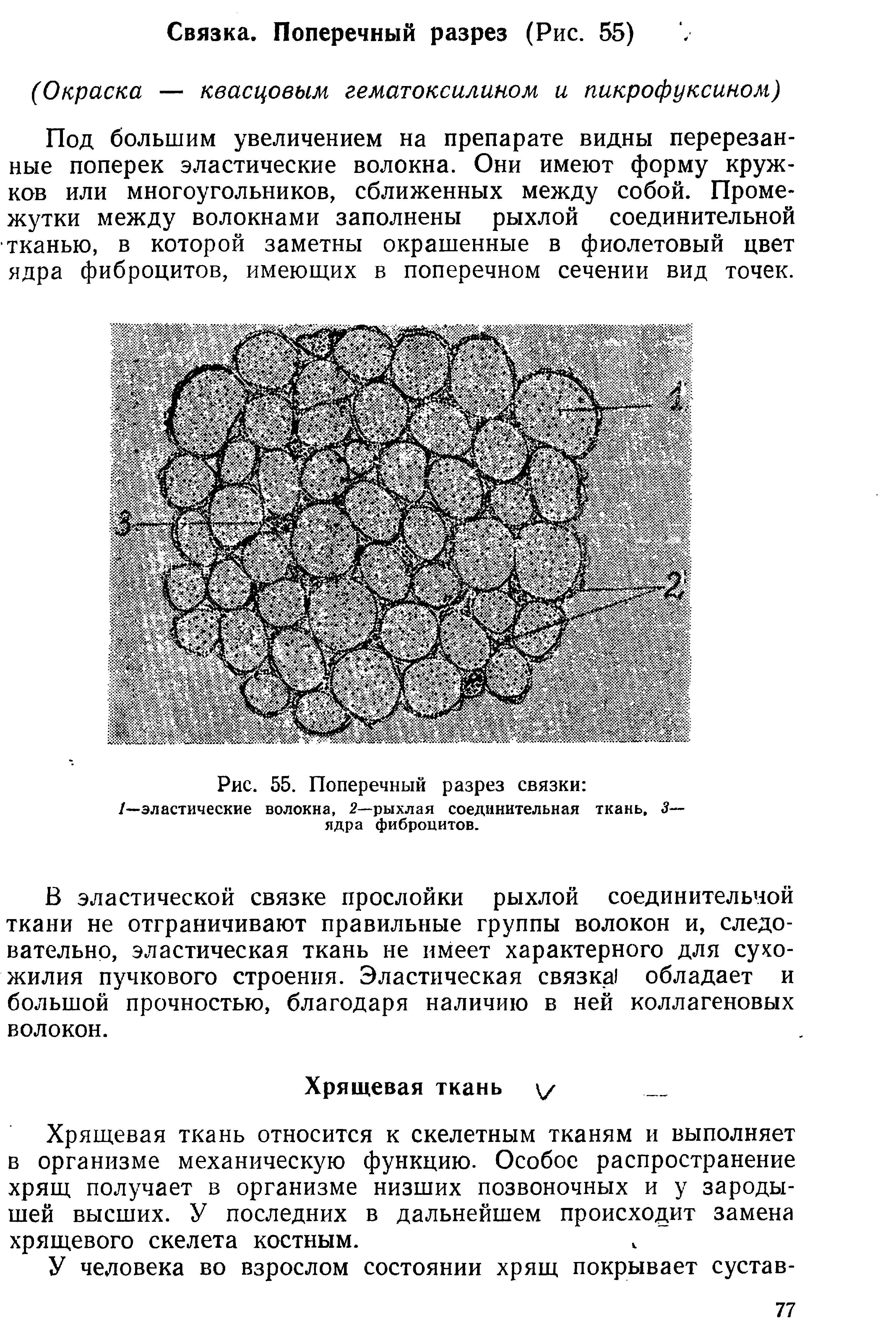 Рис. 55. Поперечный разрез связки /—эластические волокна, 2—рыхлая соединительная ткань, 5— ядра фиброцитов.