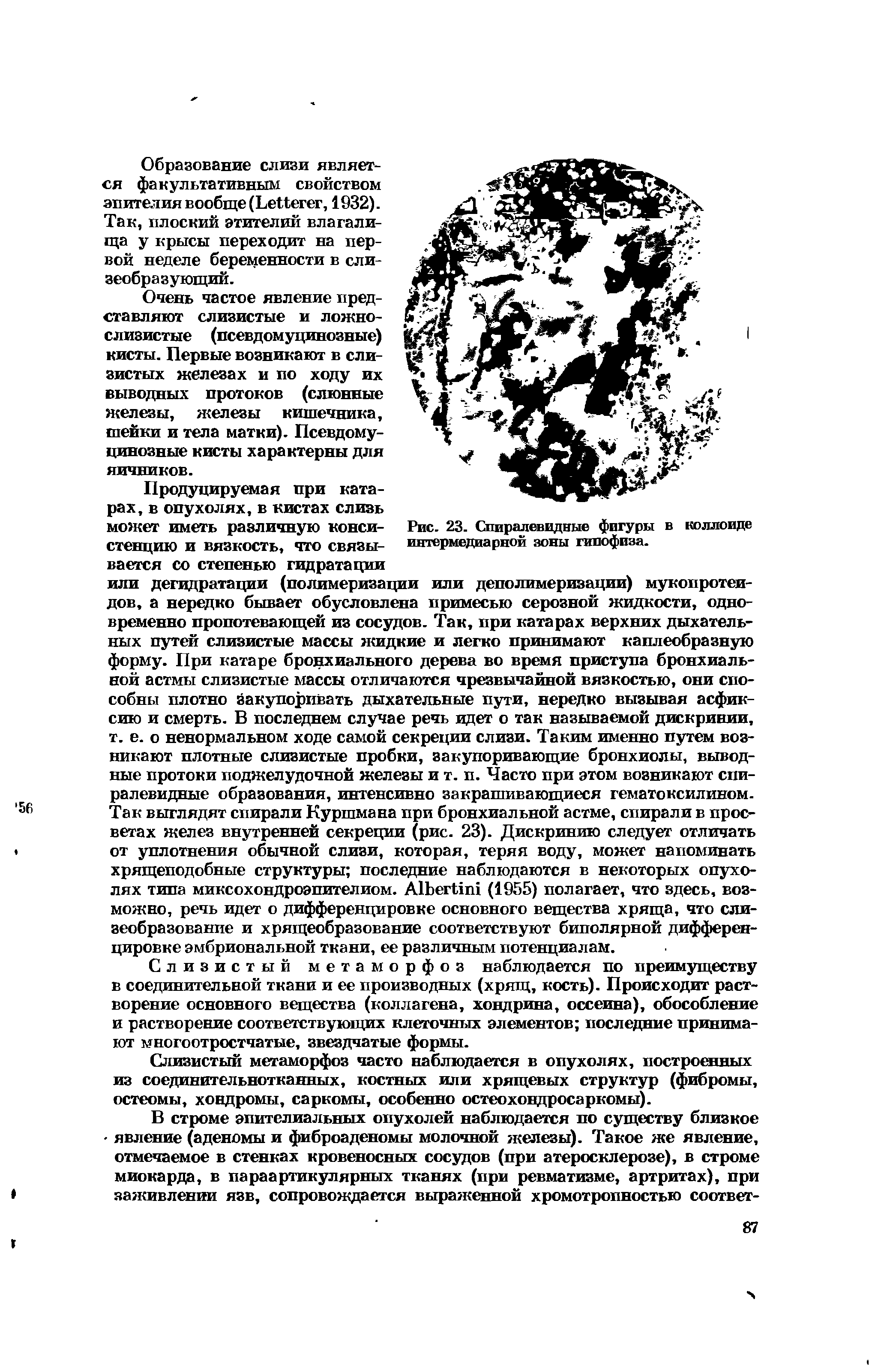 Рис. 23. Спиралевидные фигуры в коллоиде интермедиа рной зоны гипофиза.