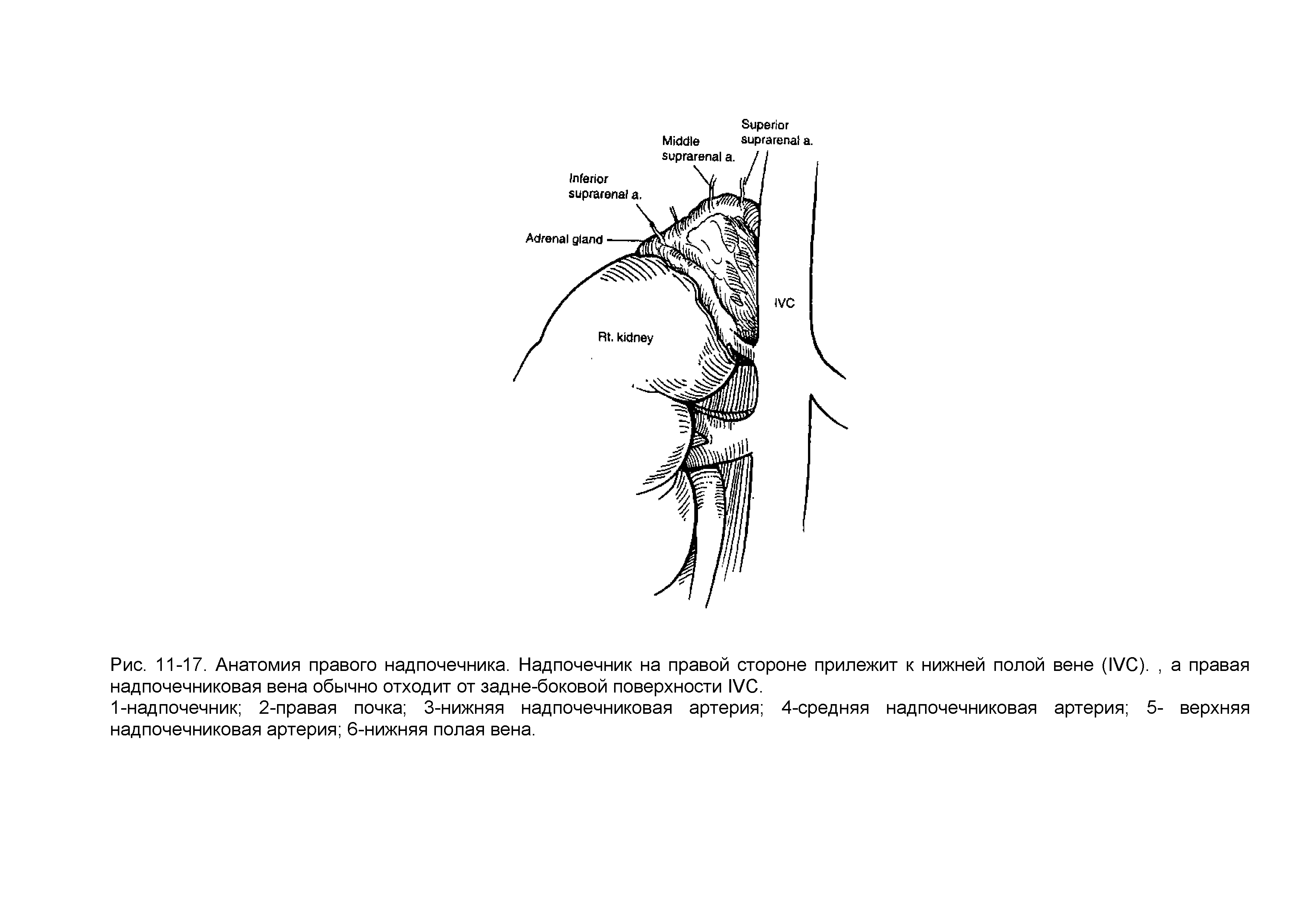 Рис. 11-17. Анатомия правого надпочечника. Надпочечник на правой стороне прилежит к нижней полой вене (1 /С)., а правая надпочечниковая вена обычно отходит от задне-боковой поверхности 1 /С.