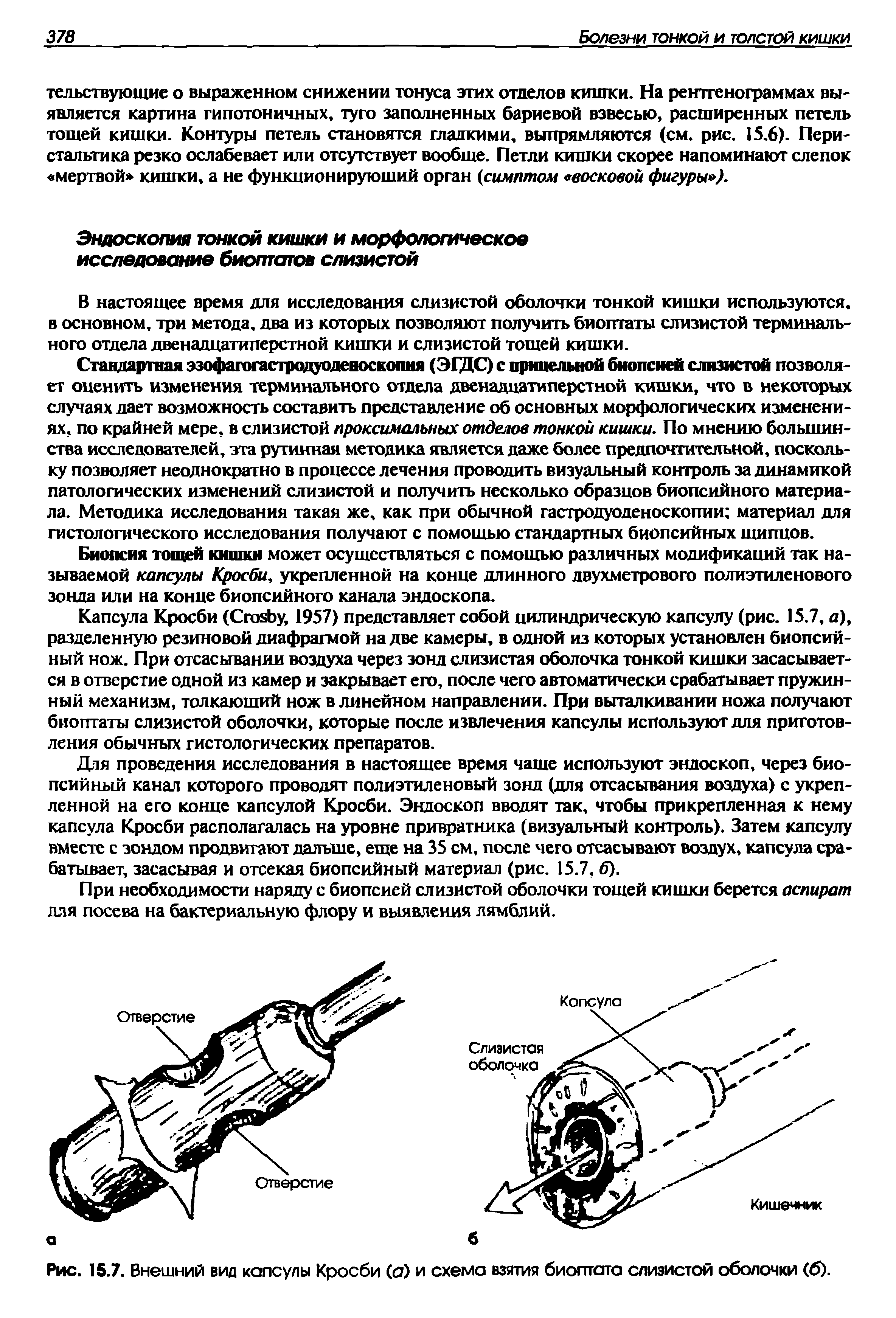 Рис. 15.7. Внешний вид капсулы Кросби (а) и схема взятия биоптата слизистой оболочки (6).