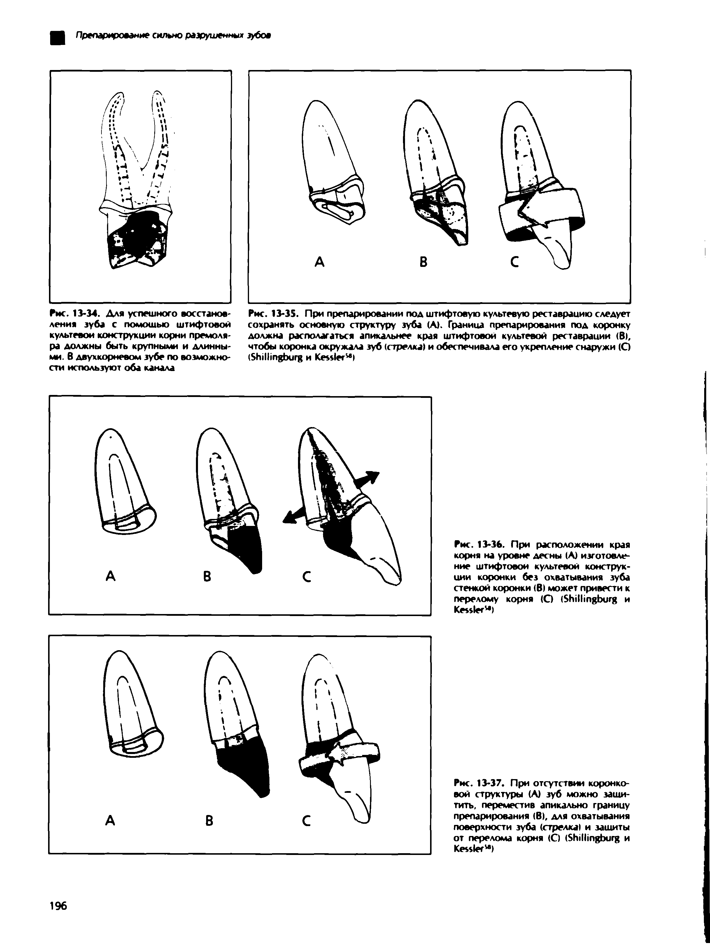 Рис. 13-35. При препарировании под штифтовую культевую реставрацию следует сохранять основную структуру зуба (А). Граница препарирования под коронку должна располагаться апикальнее края штифтовой культевой реставрации (В), чтобы коронка окружала зуб (стрелка) и обеспечивала его укрепление снаружи (О (S и K )...