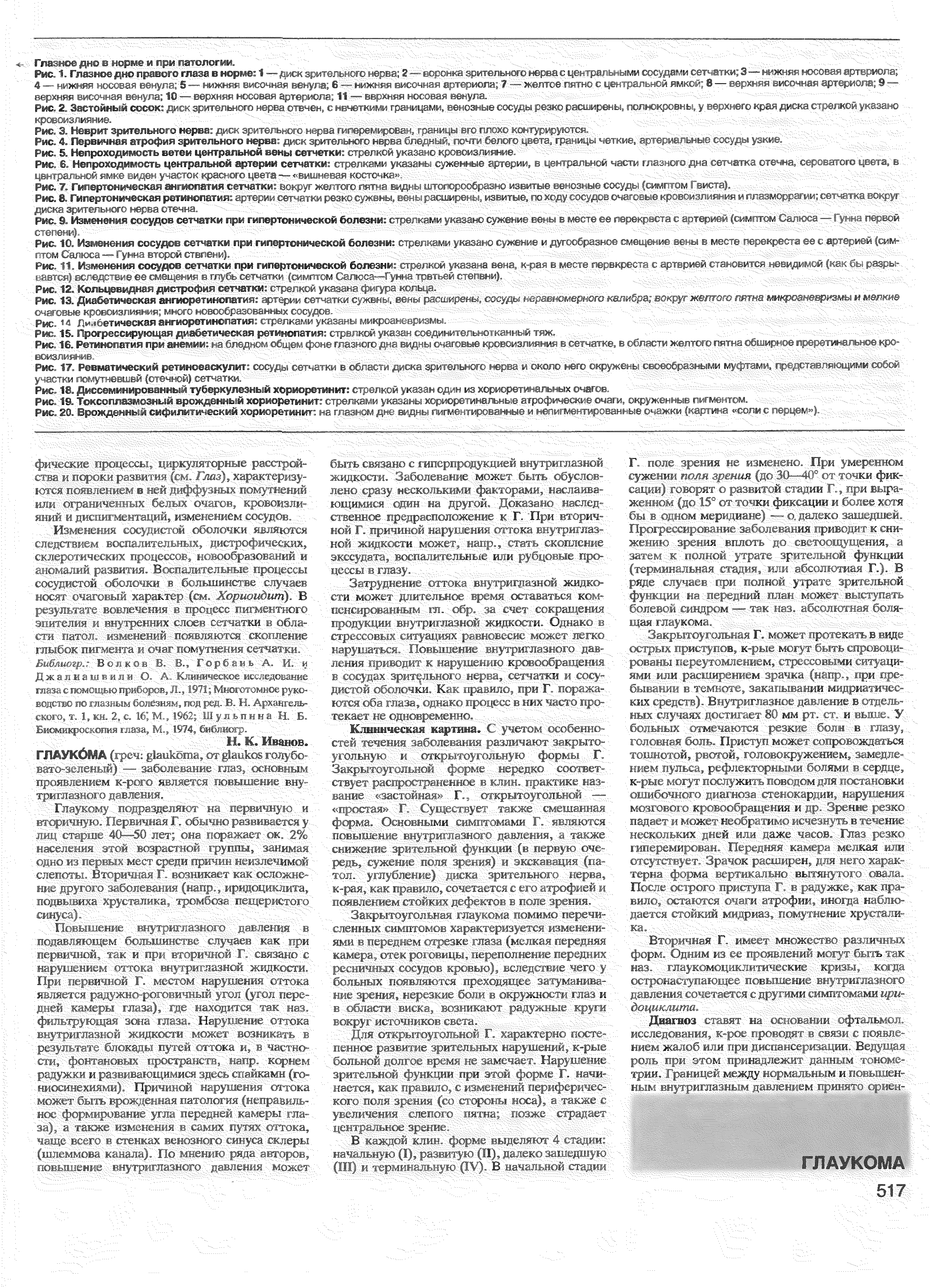 Рис. 3. Неврит зрительного нерва диск зрительного нерва гиперемирован. границы его плохо контурируются. У у у у Ууед доУУ-У У- У У, ...