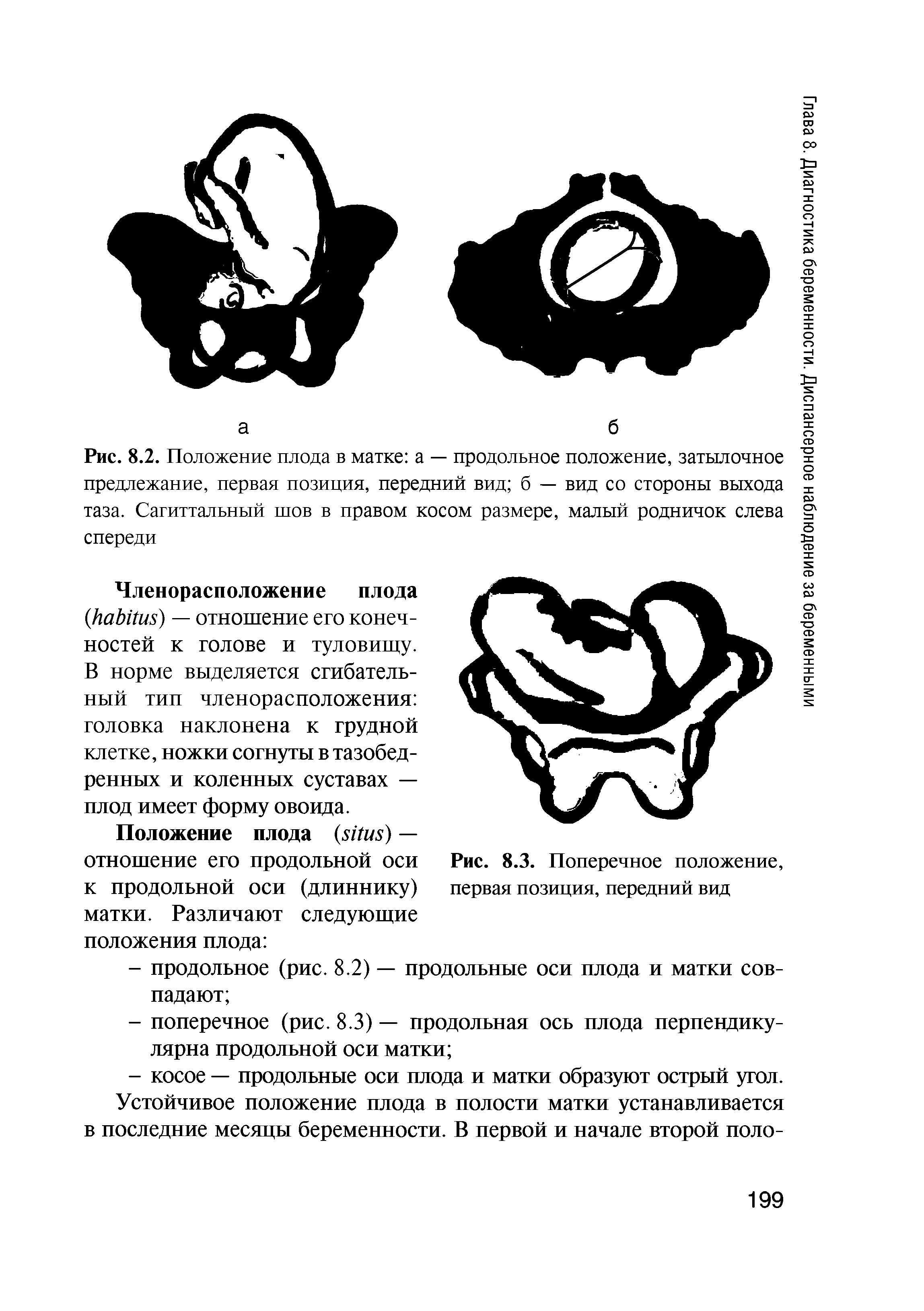 Рис. 8.2. Положение плода в матке а — продольное положение, затылочное предлежание, первая позиция, передний вид б — вид со стороны выхода таза. Сагиттальный шов в правом косом размере, малый родничок слева спереди...