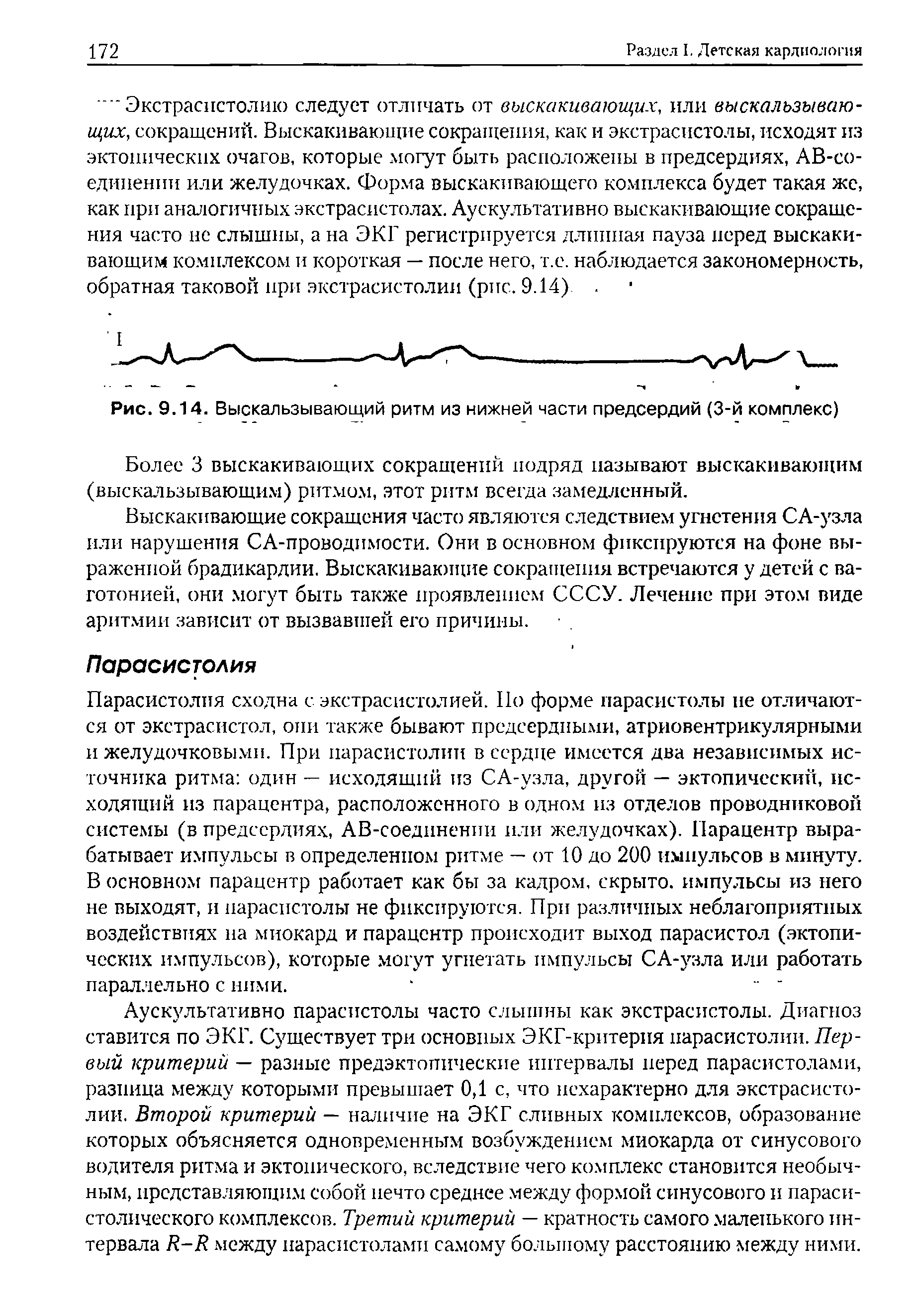 Рис. 9.14. Выскальзывающий ритм из нижней части предсердий (3-й комплекс)...