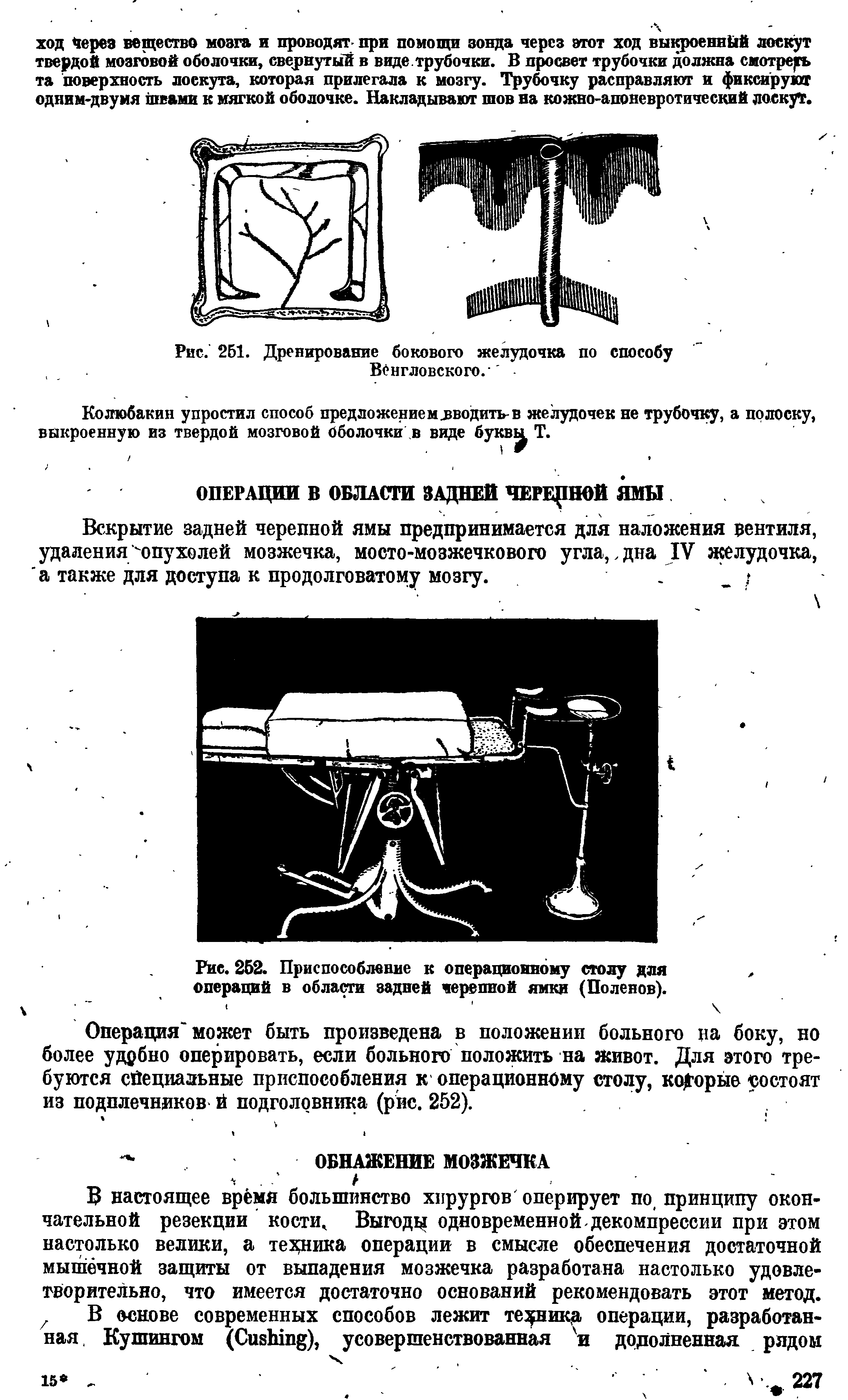 Рис. 252. Приспособление к операционному столу для операций в области задней черепной ямки (Поленов).