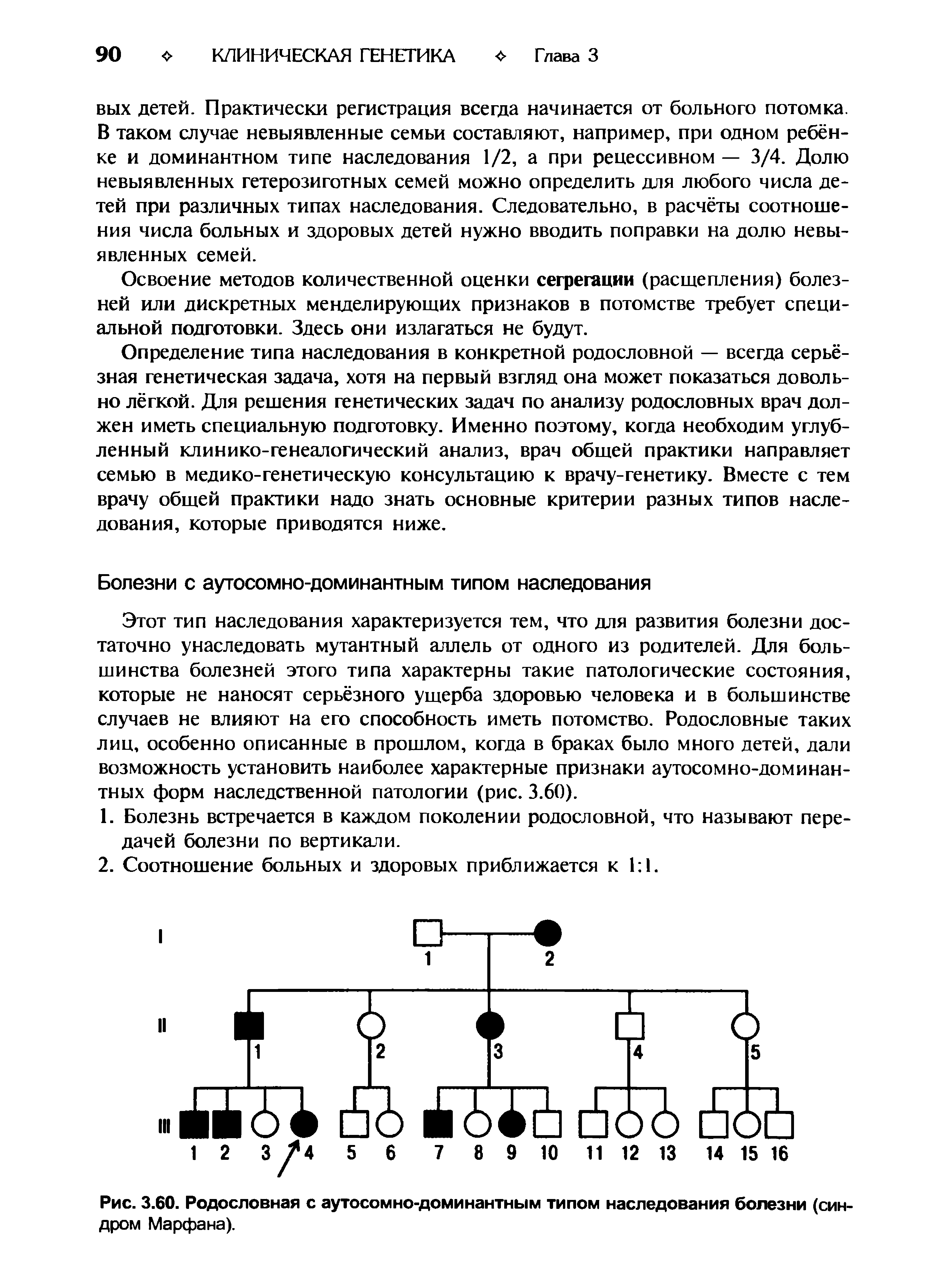 Рис. 3.60. Родословная с аутосомно-доминантным типом наследования болезни (синдром Марфана).