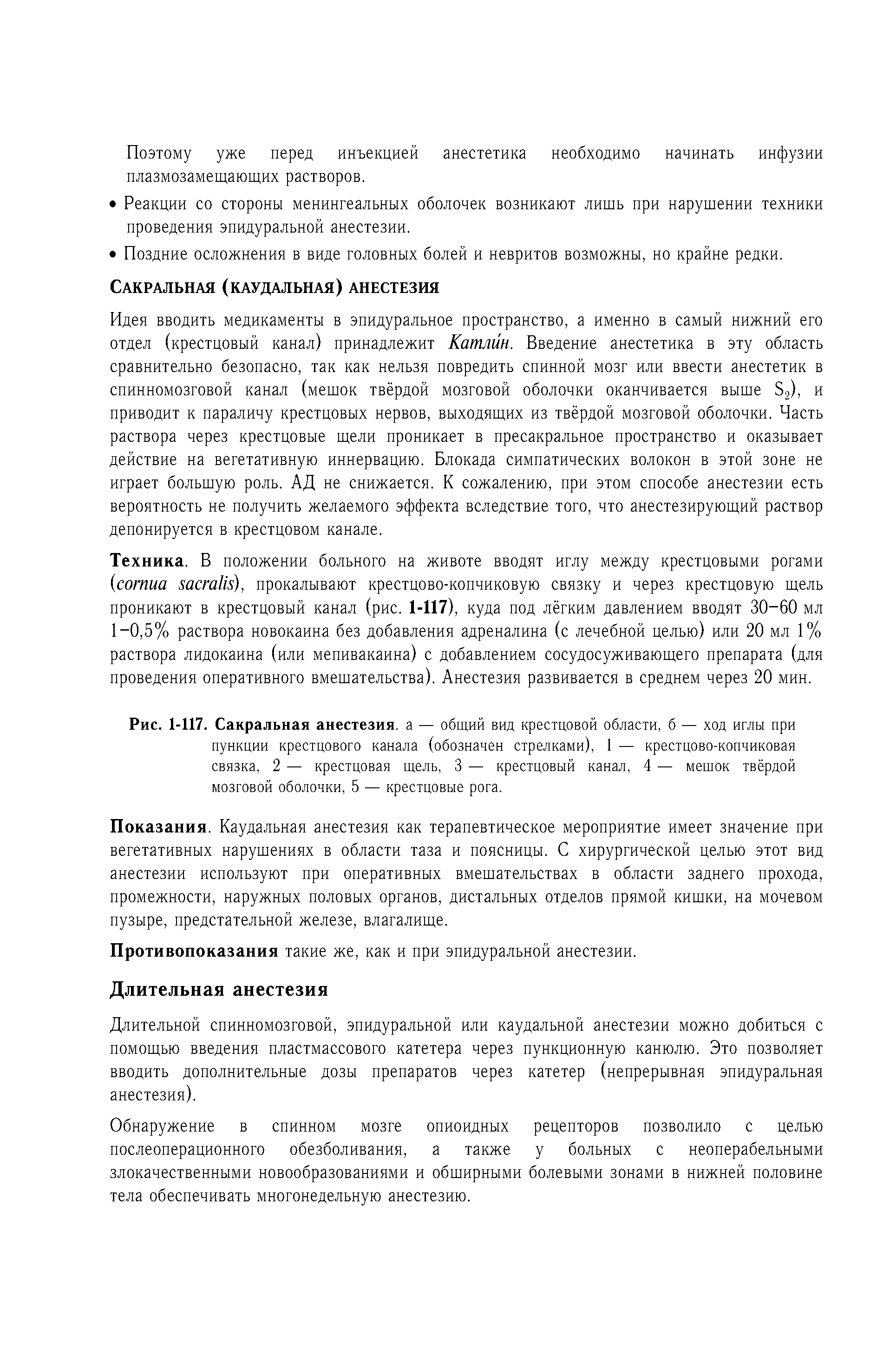 Рис. 1-117. Сакральная анестезия, а — общий вид крестцовой области, б — ход иглы при пункции крестцового канала (обозначен стрелками), 1 — крестцово-копчиковая связка, 2 — крестцовая щель, 3 — крестцовый канал, 4 — мешок твёрдой мозговой оболочки, 5 — крестцовые рога.