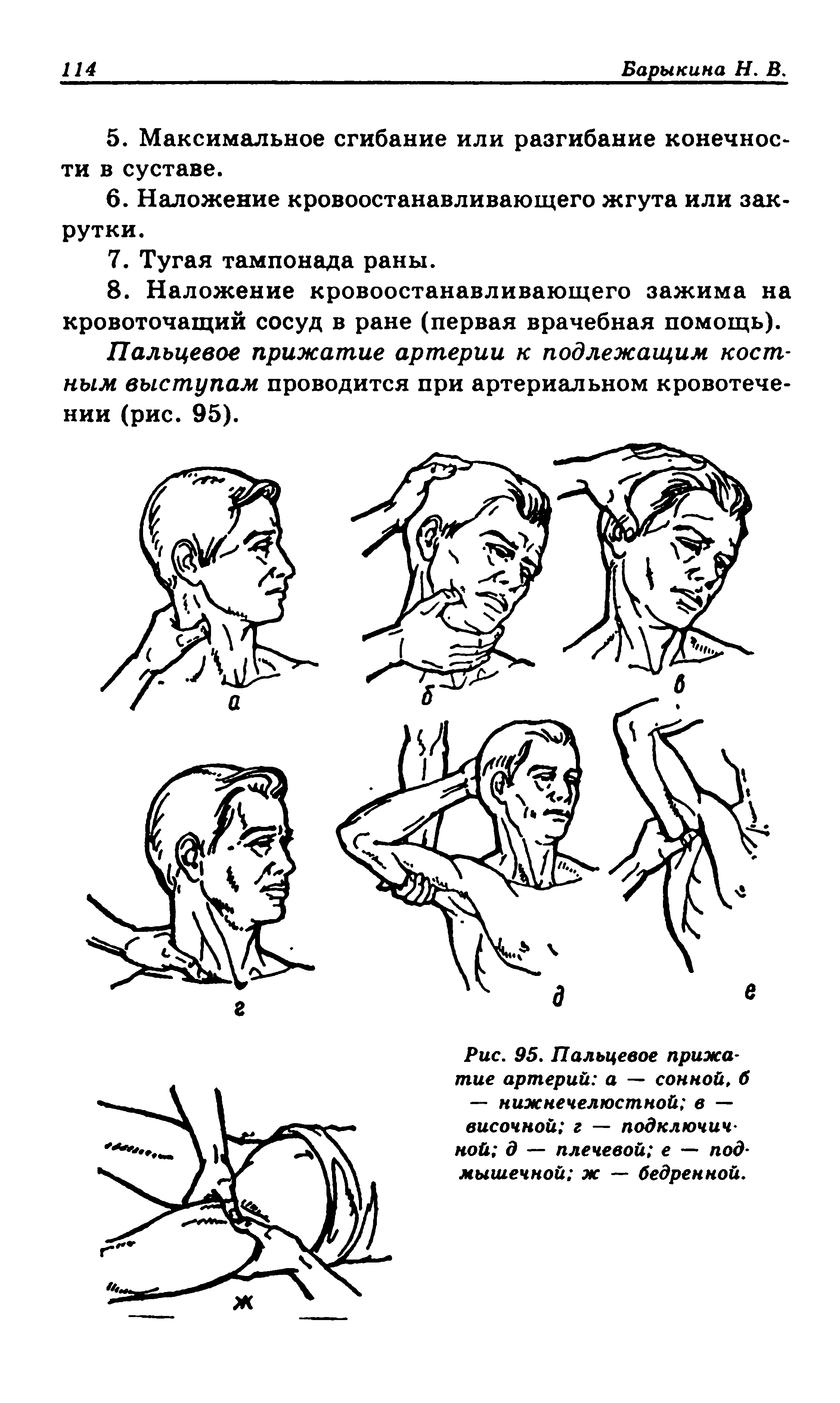 Рис. 95. Пальцевое прижатие артерий а — сонной, б — нижнечелюстной в — височной г — подключичной д — плечевой е — подмышечной ж — бедренной.