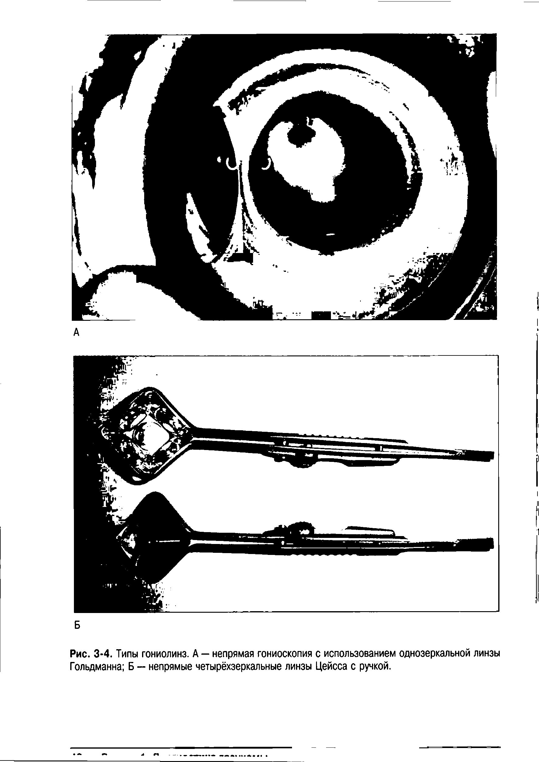 Рис. 3-4. Типы гониолинз. А — непрямая гониоскопия с использованием однозеркальной линзы Гольдманна Б — непрямые четырёхзеркальные линзы Цейсса с ручкой.
