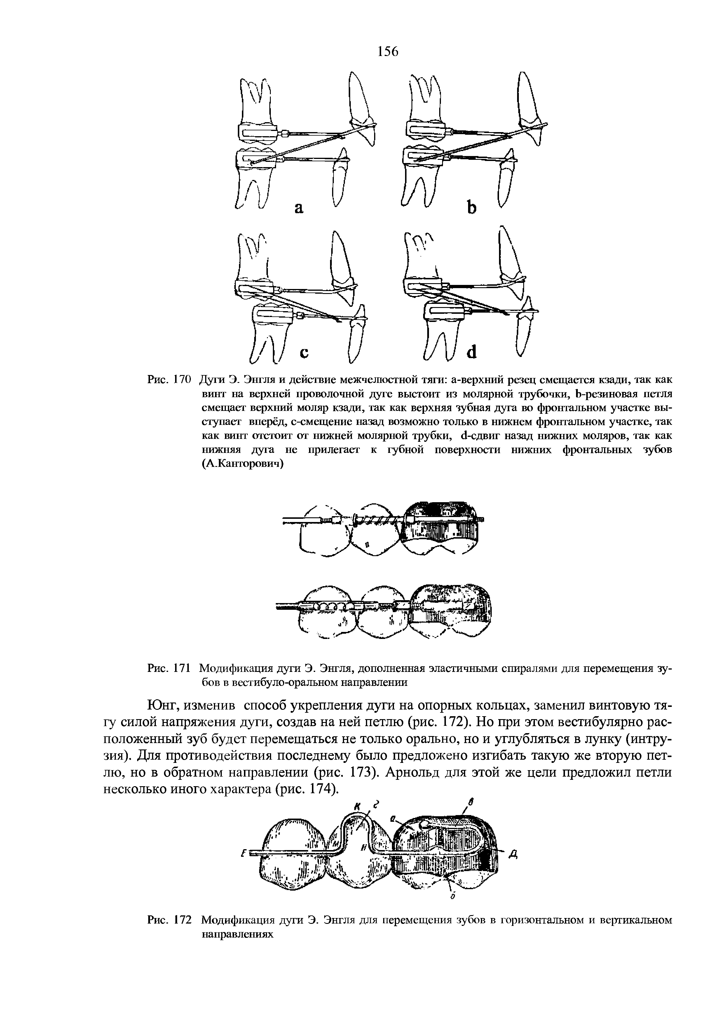 Рис. 172 Модификация дуги Э. Энгля для перемещения зубов в горизонтальном и вертикальном направлениях...