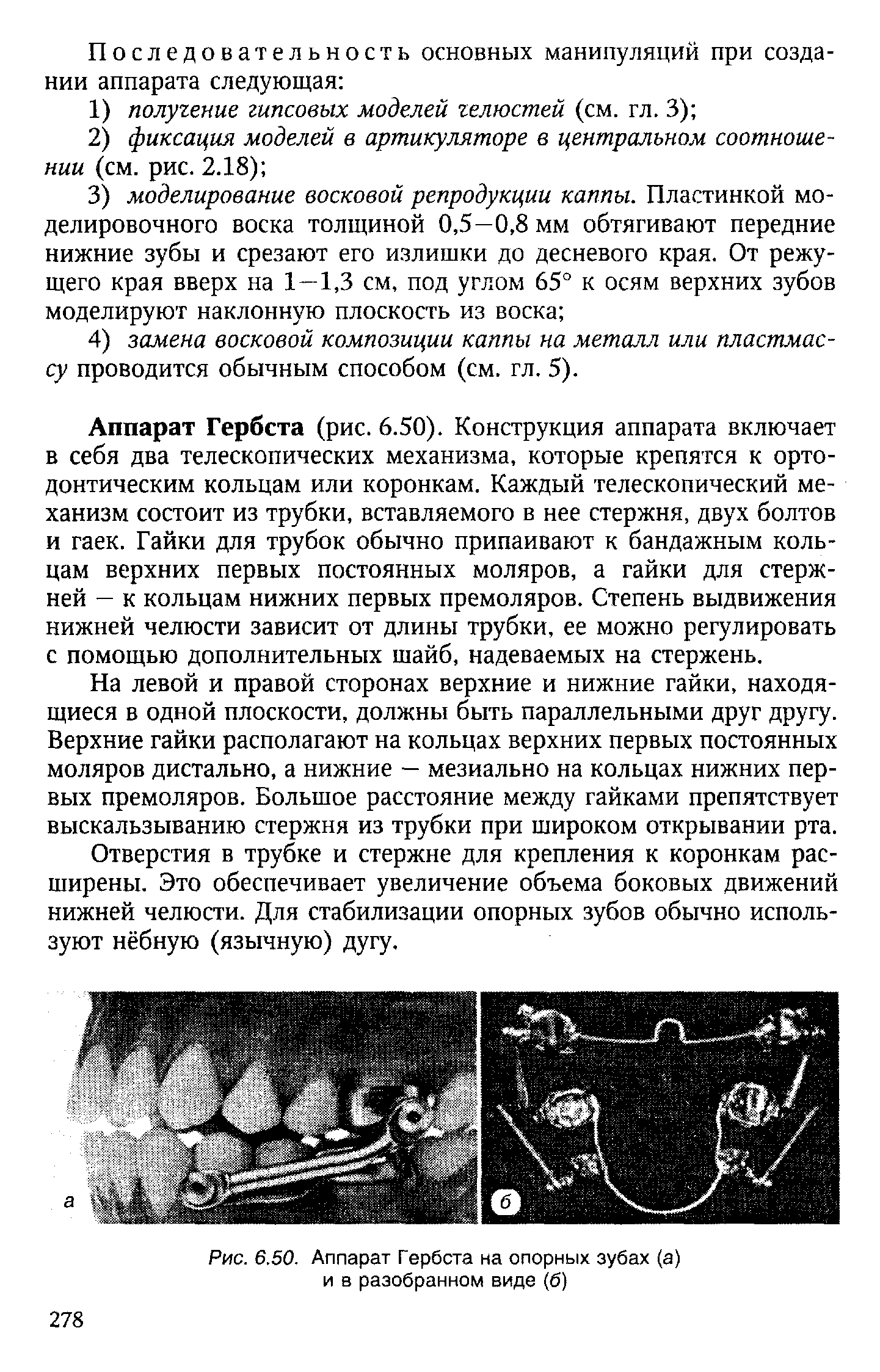 Рис. 6.50. Аппарат Гербста на опорных зубах (а) и в разобранном виде (б)...