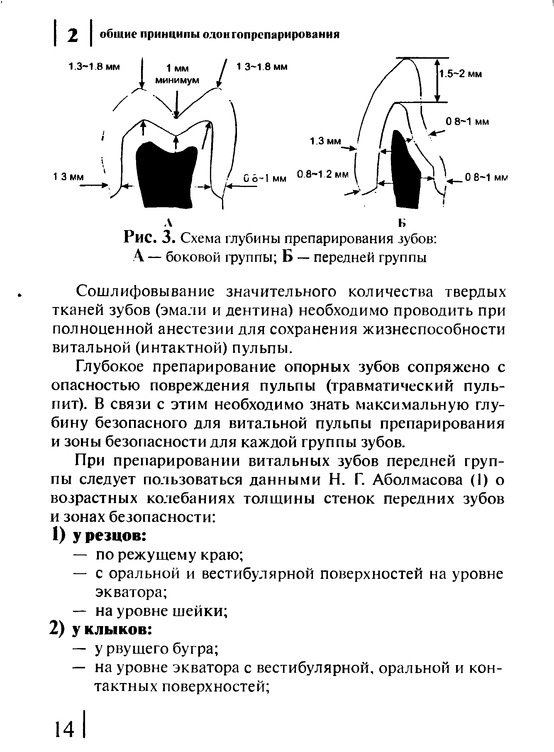 Рис. 3. Схема глубины препарирования зубов А — боковой группы Б — передней группы...