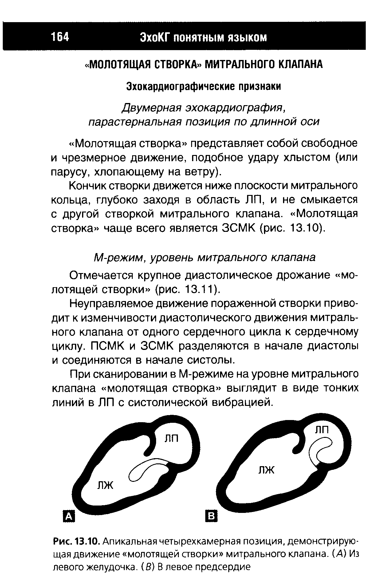 Рис. 13.10. Апикальная четырехкамерная позиция, демонстрирующая движение молотящей створки митрального клапана. (А) Из левого желудочка. (В) В левое предсердие...