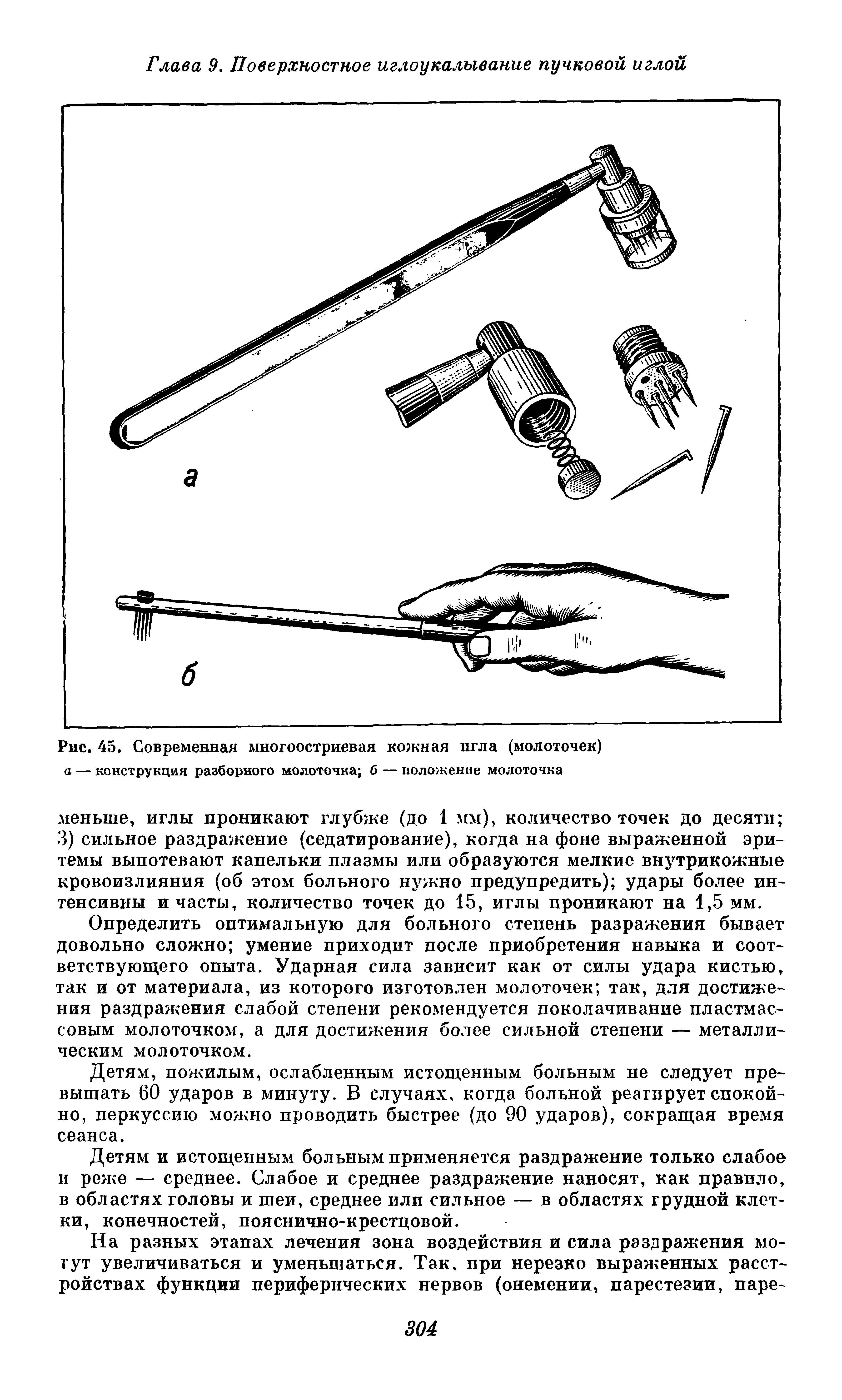 Рис. 45. Современная многоостриевая кожная игла (молоточек) а — конструкция разборного молоточка б — положение молоточка...