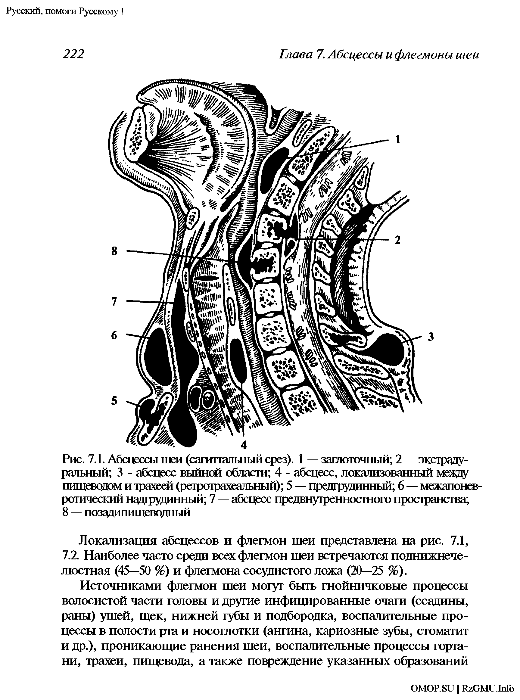 Рис. 7.1. Абсцессы шеи (сагиттальный срез). 1 — заглоточный 2 — экстрадуральный 3 - абсцесс выйной области 4 - абсцесс, локализованный между пищеводом и трахеей (ретротрахеальный) 5 — предгрудинный 6 — межапоневротический надгрудинный 7 — абсцесс предвнутренностного пространства ...