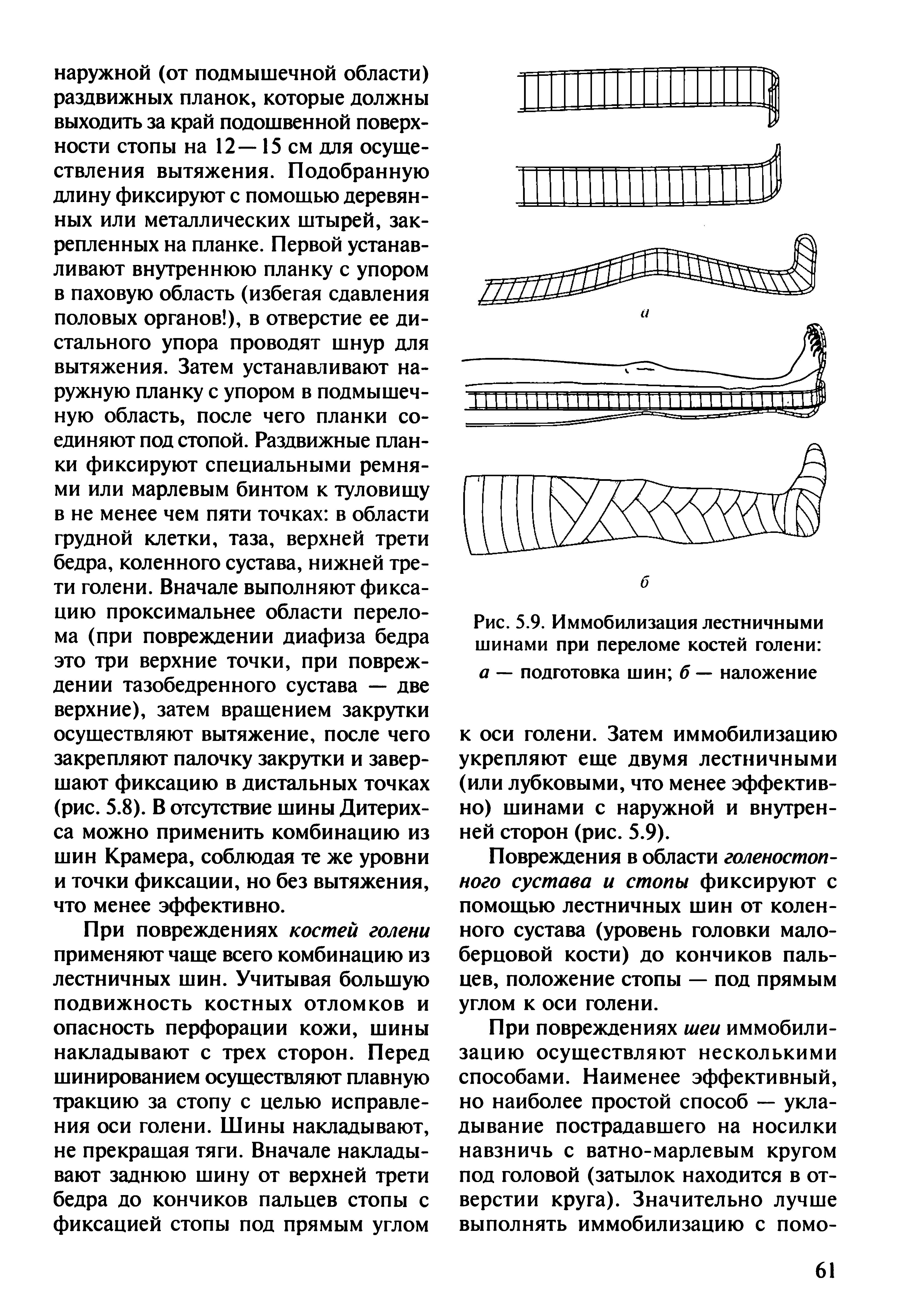 Рис. 5.9. Иммобилизация лестничными шинами при переломе костей голени а — подготовка шин б — наложение...