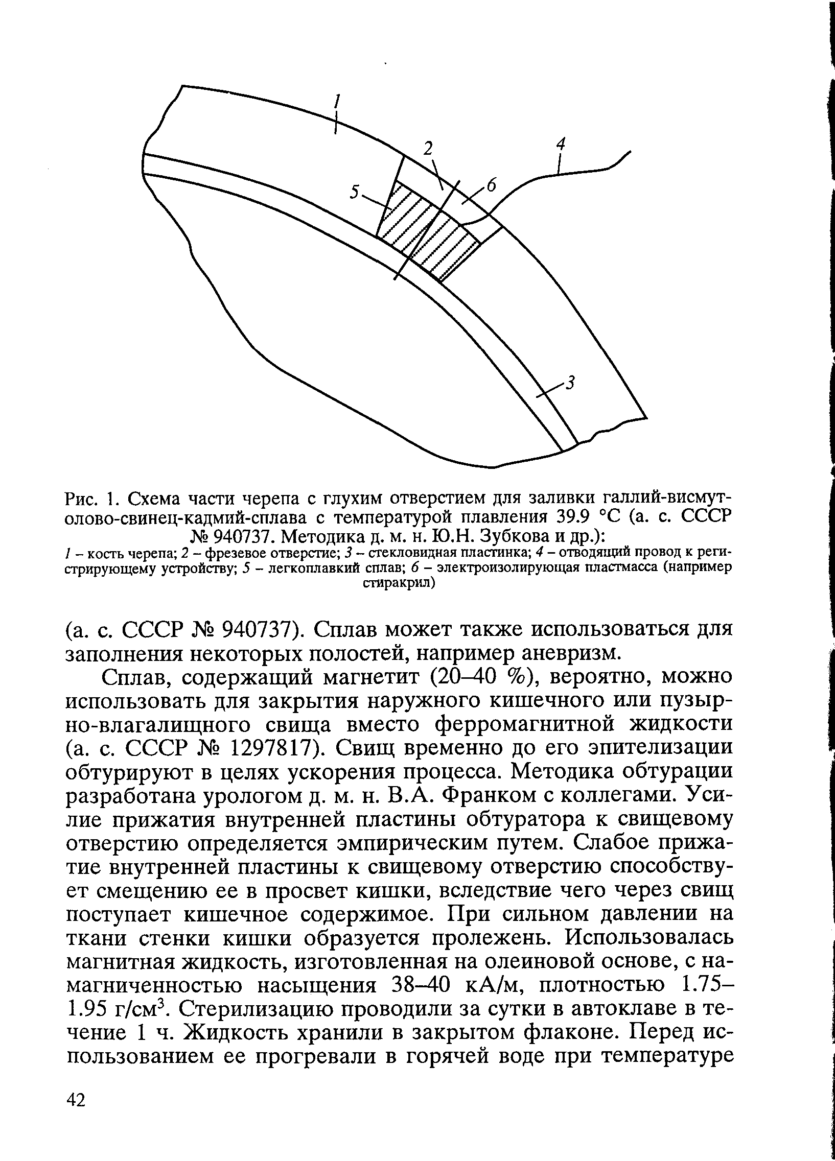 Рис. 1. Схема части черепа с глухим отверстием для заливки галлий-висмут-олово-свинец-кадмий-сплава с температурой плавления 39.9 °С (а. с. СССР № 940737. Методика д. м. н. Ю.Н. Зубкова и др.) ...