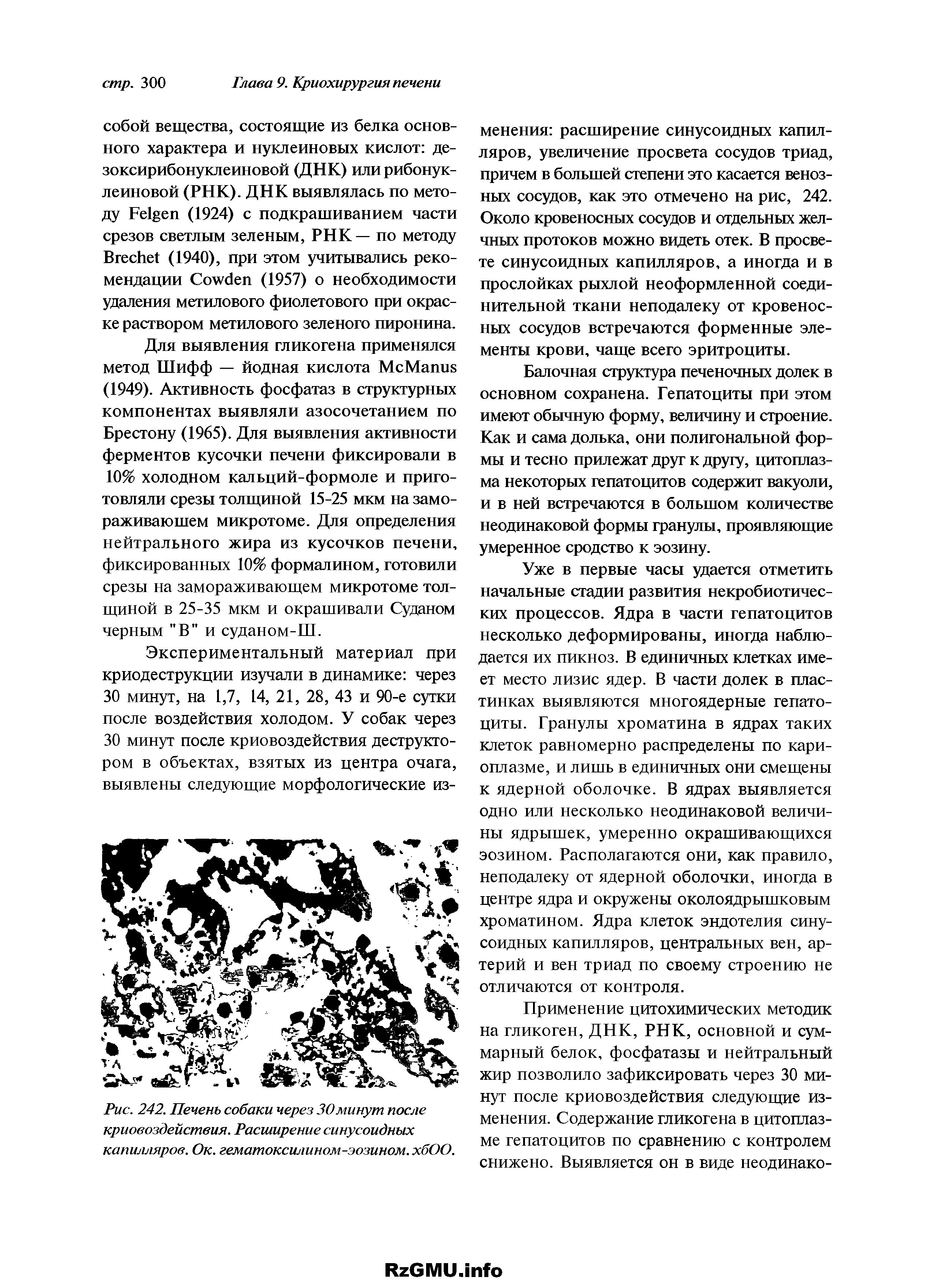 Рис. 242. Печень собаки через 30минут после криовоздействия. Расширение синусоидных капилляров. Ок. гематоксилином-эозином. хбОО.