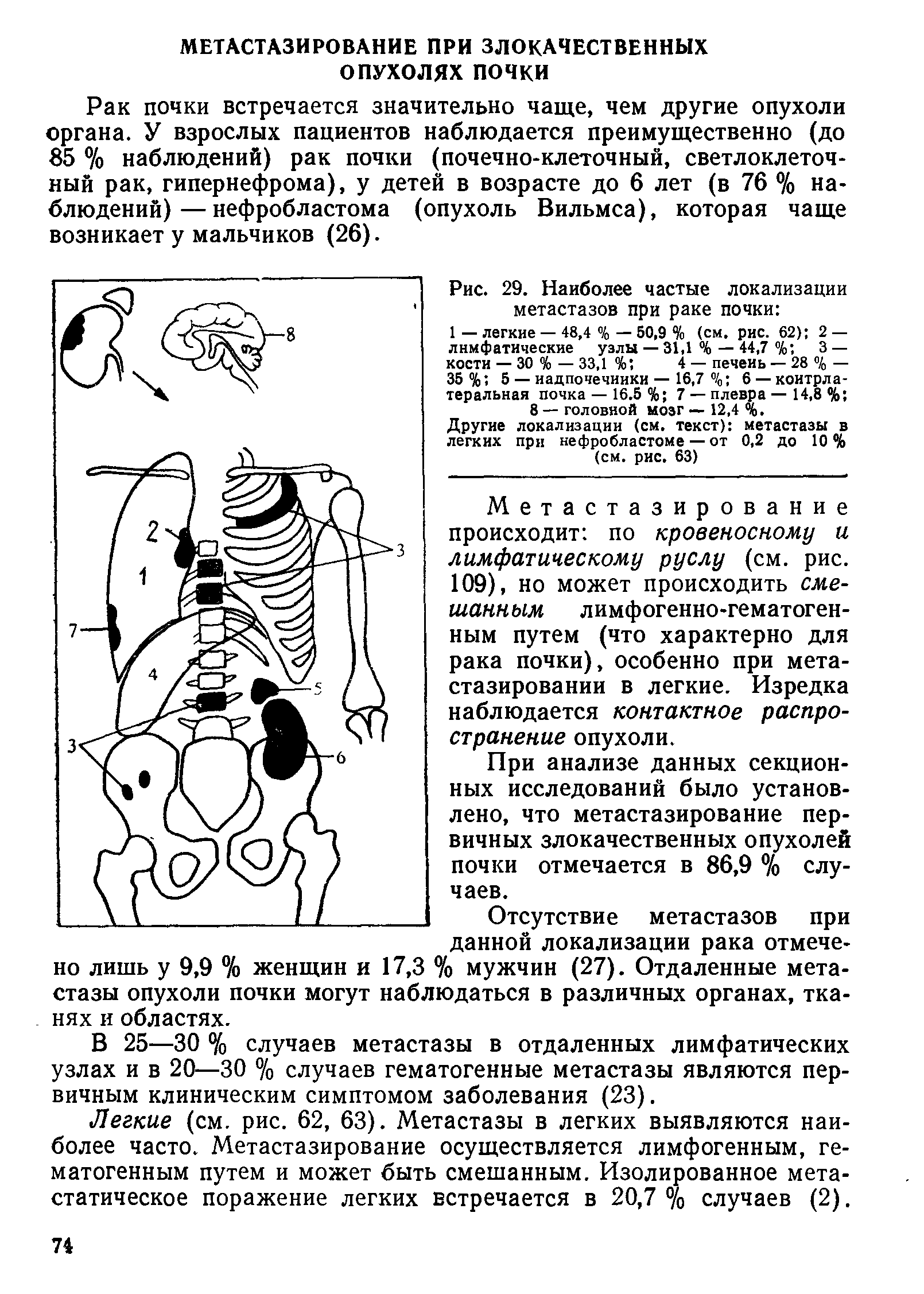 Рис. 29. Наиболее частые локализации метастазов при раке почки ...