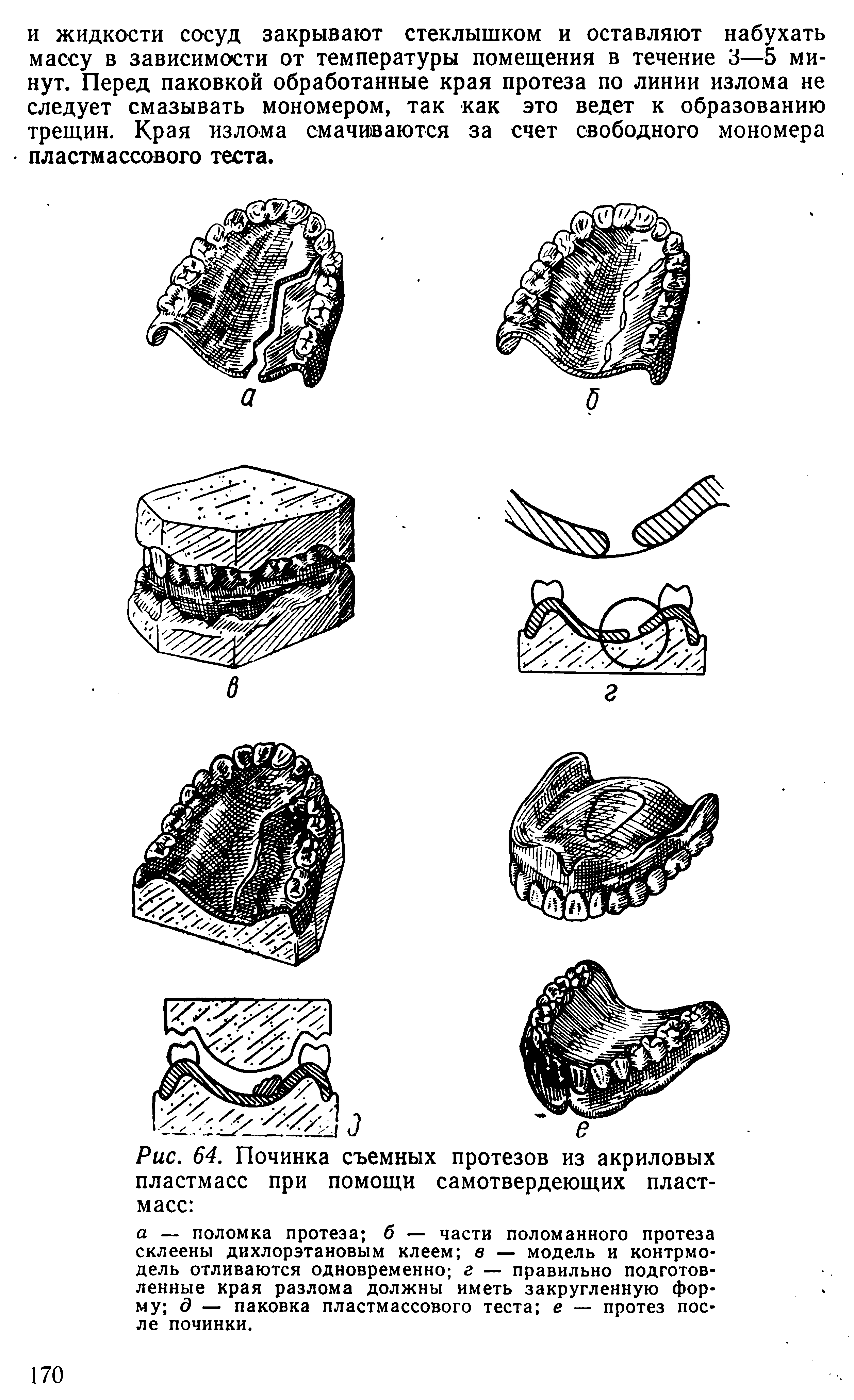 Рис. 64. Починка съемных протезов из акриловых пластмасс при помощи самотвердеющих пластмасс ...