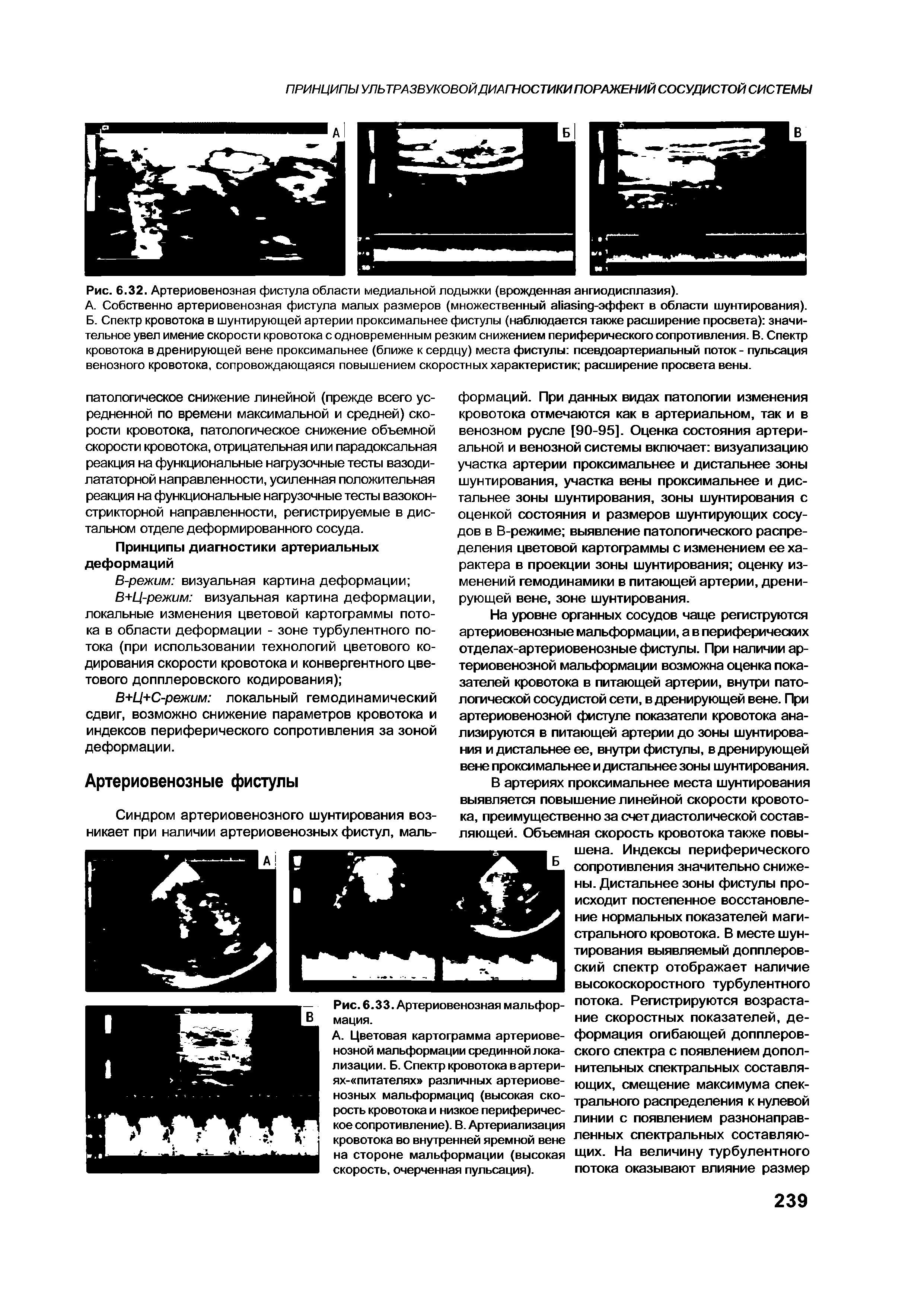 Рис. 6.32. Артериовенозная фистула области медиальной лодыжки (врожденная ангиодисплазия).