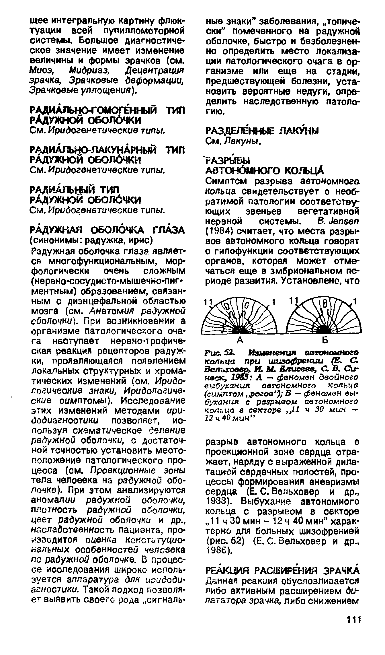 Рис. 52. Изменения автономного кольца при шизофрении (Е. С. Велысоевр, И. М. Елисеев, С. В. Си-неск, 1983 А — феномен двойного выбухания автономного кольца (симптом рогов ) Б — феномен выбухания с разрывом автономного кольца е секторе 11 ч 30 мин — 12 ч 40 мин ...